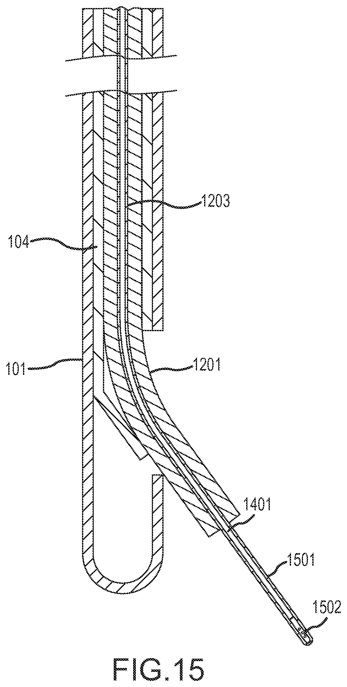Patent US12090283 Figure 12 – Microinjection catheter