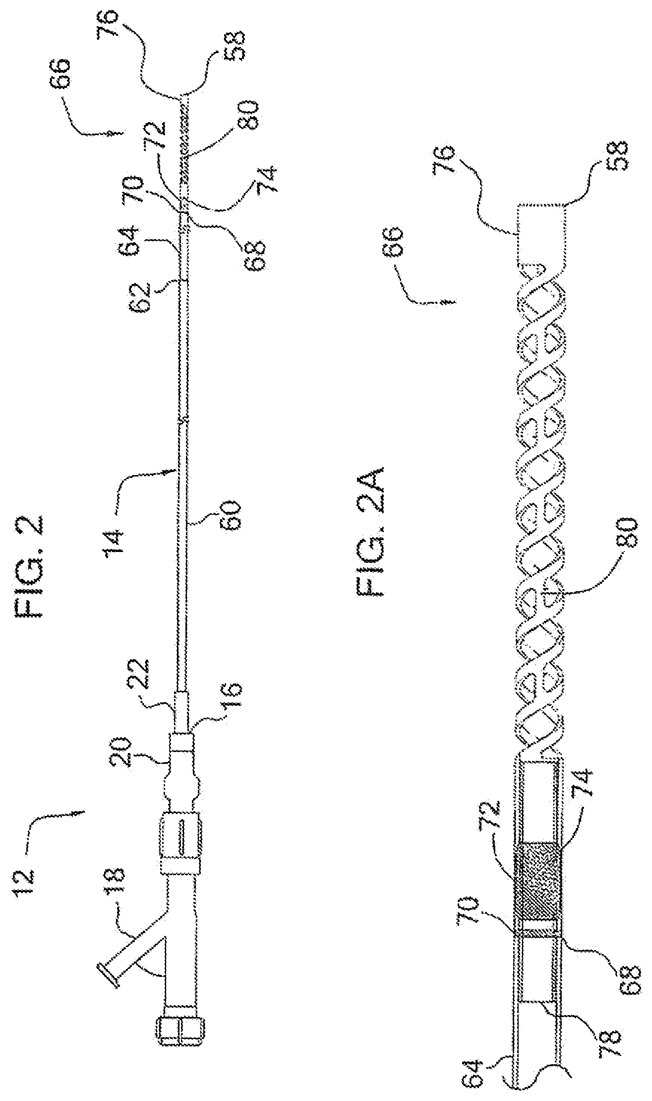 Patent US12090285 Figure 2 – Coaxial bi-directional catheter