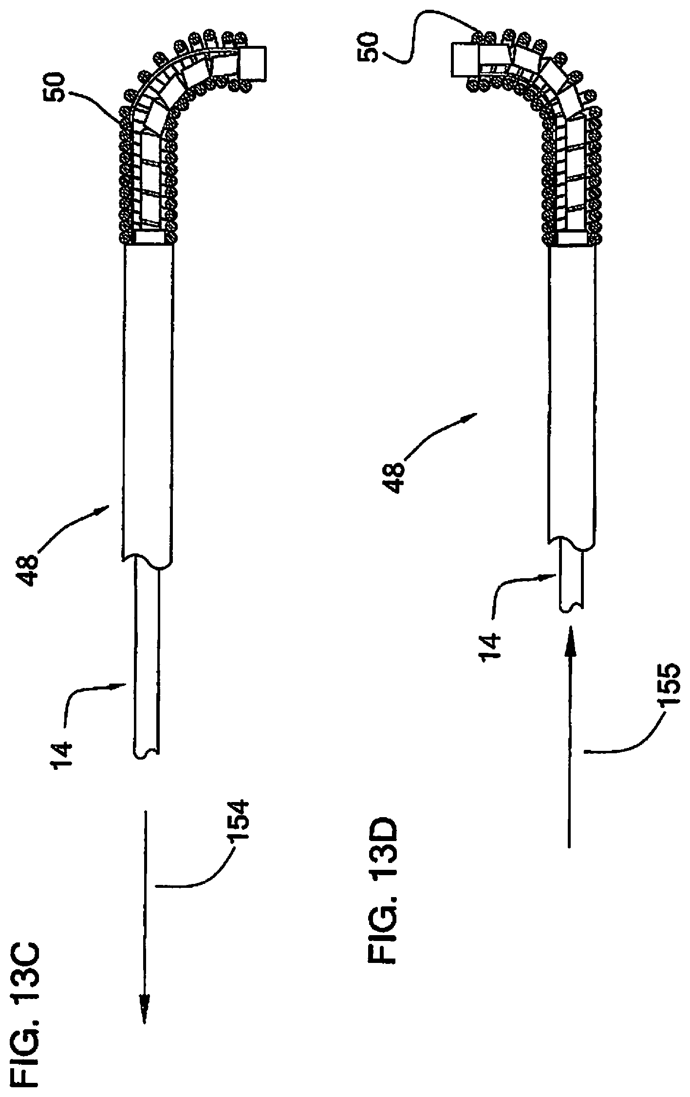 Patent US12090285 Figure 9 – Coaxial bi-directional catheter
