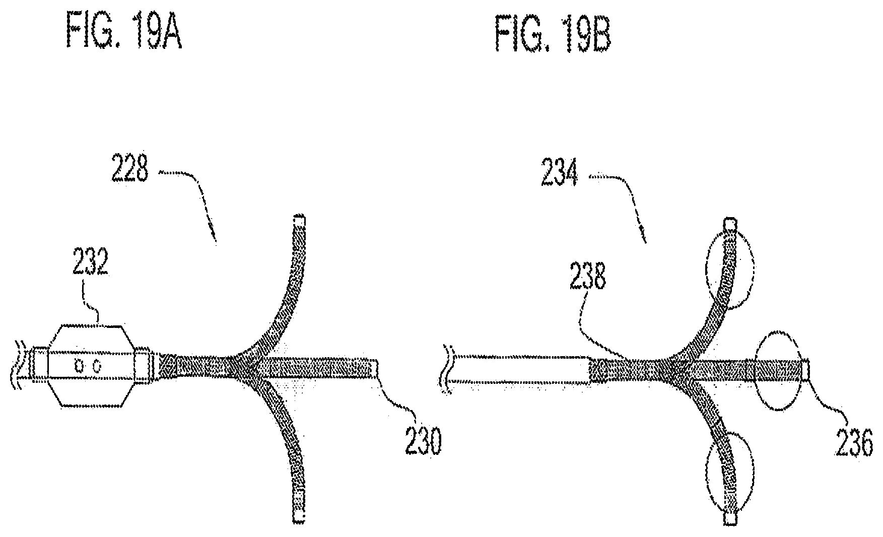 Patent US12090285 Figure 13 – Coaxial bi-directional catheter