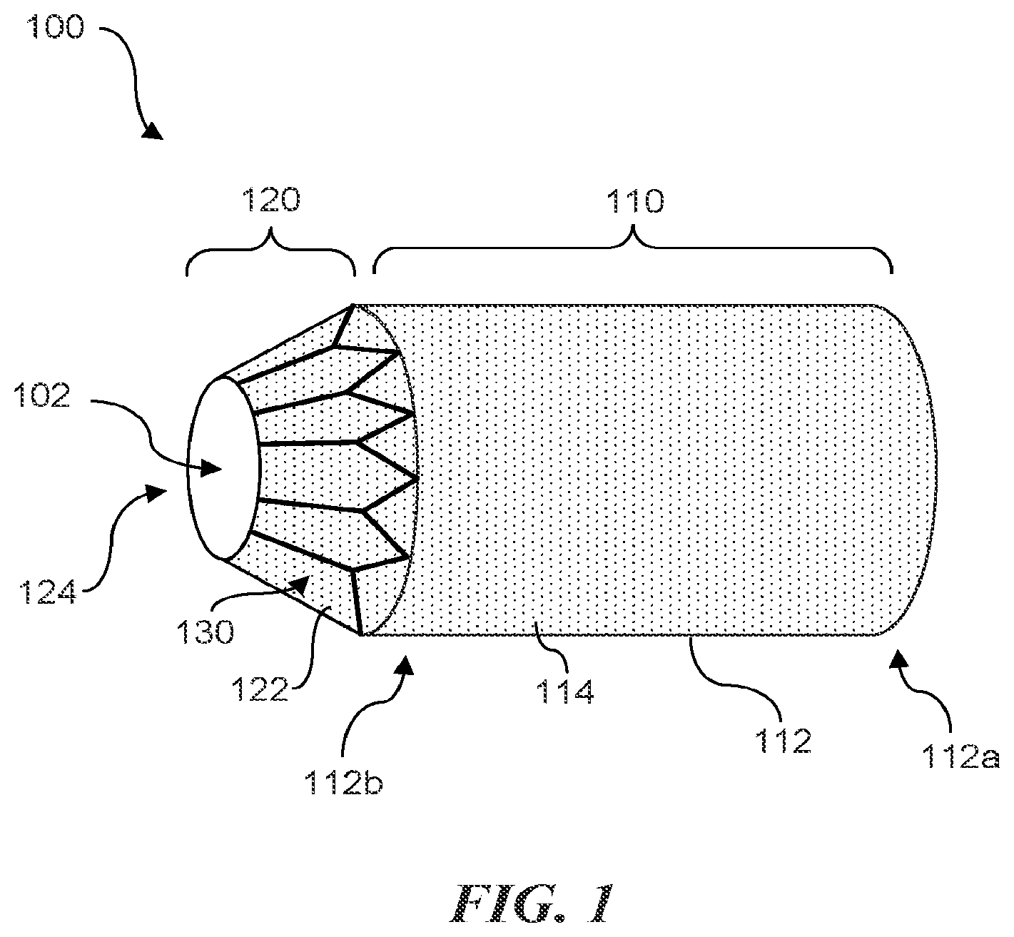 Patent US12090290 Figure 1 – Shape memory actuators for adjustable shunting systems, and associated systems and methods