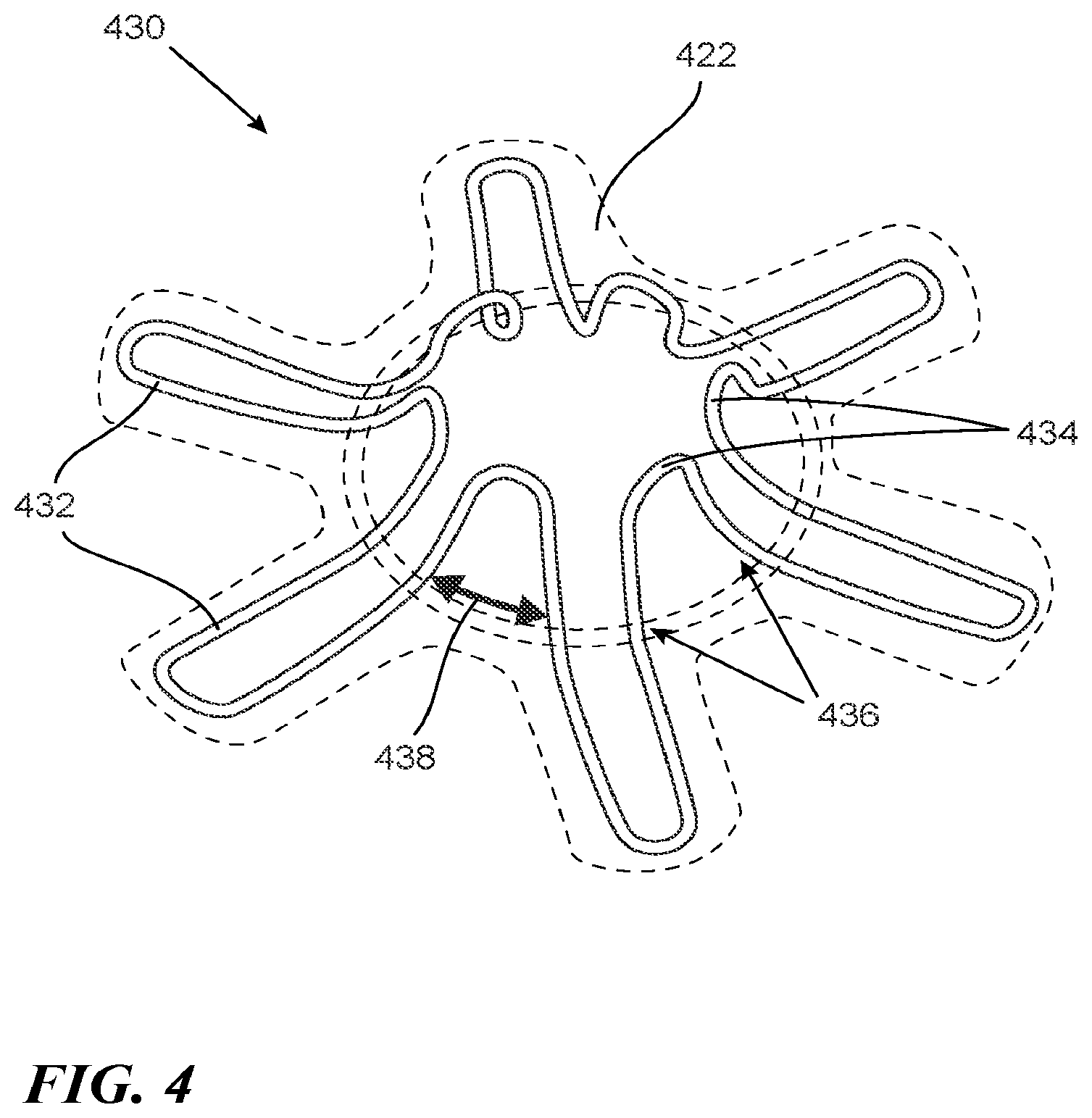Patent US12090290 Figure 5 – Shape memory actuators for adjustable shunting systems, and associated systems and methods
