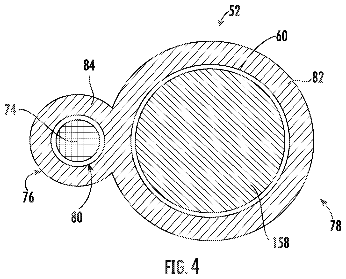 Patent US12090292 Figure 4 – Drug delivery devices and methods for drug delivery