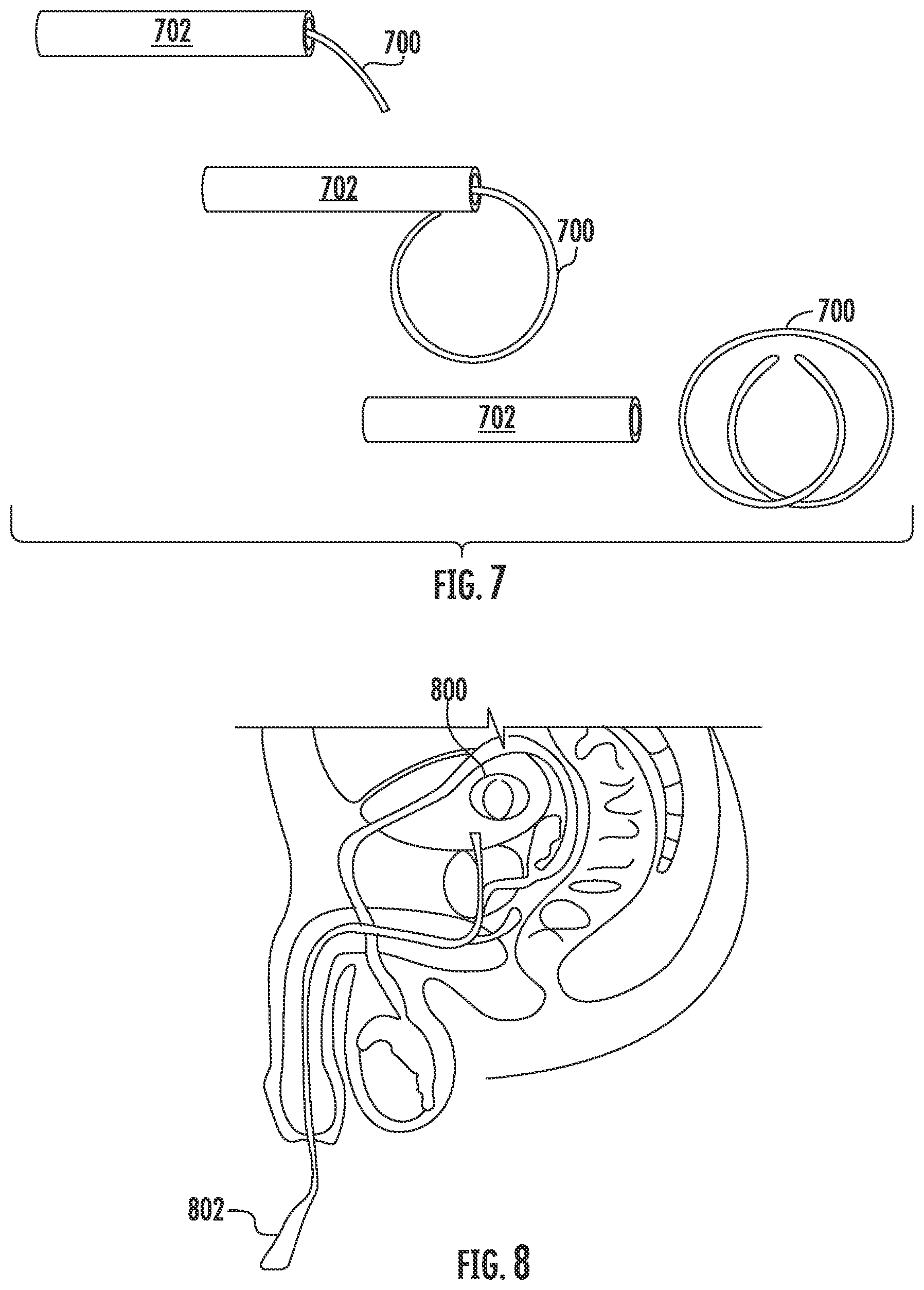Patent US12090292 Figure 6 – Drug delivery devices and methods for drug delivery