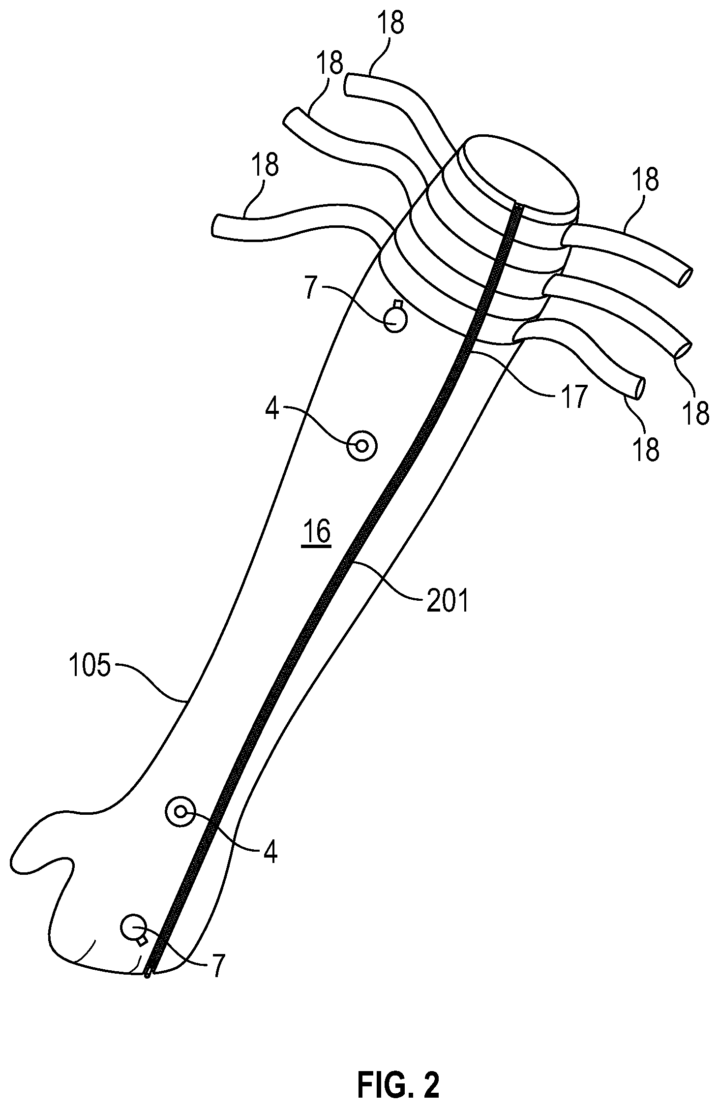 Patent US12090293 Figure 2 – Burn and wound healing suit and method