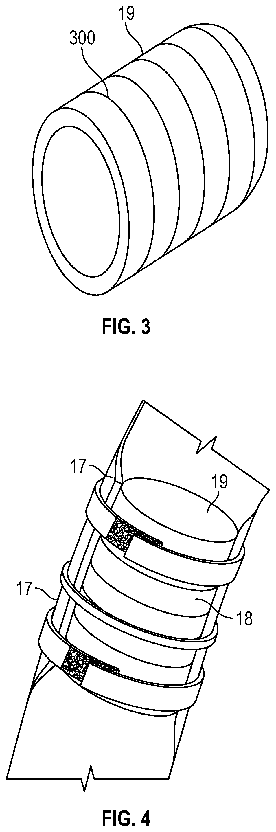 Patent US12090293 Figure 3 – Burn and wound healing suit and method