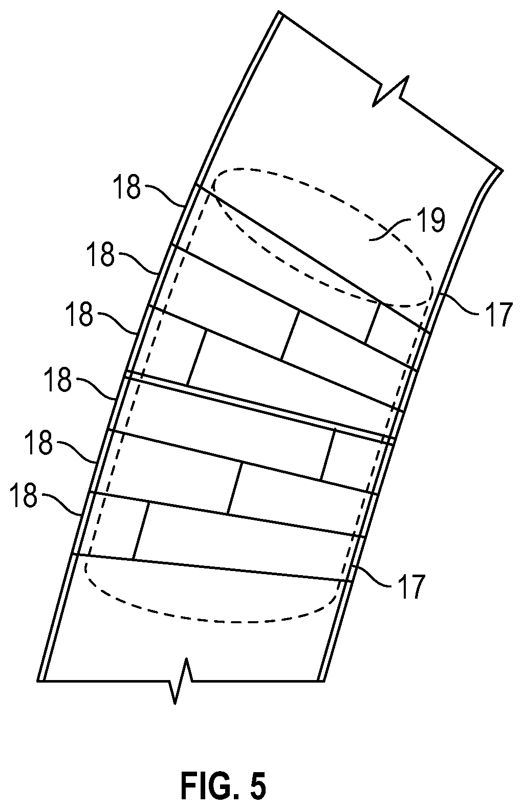 Patent US12090293 Figure 4 – Burn and wound healing suit and method