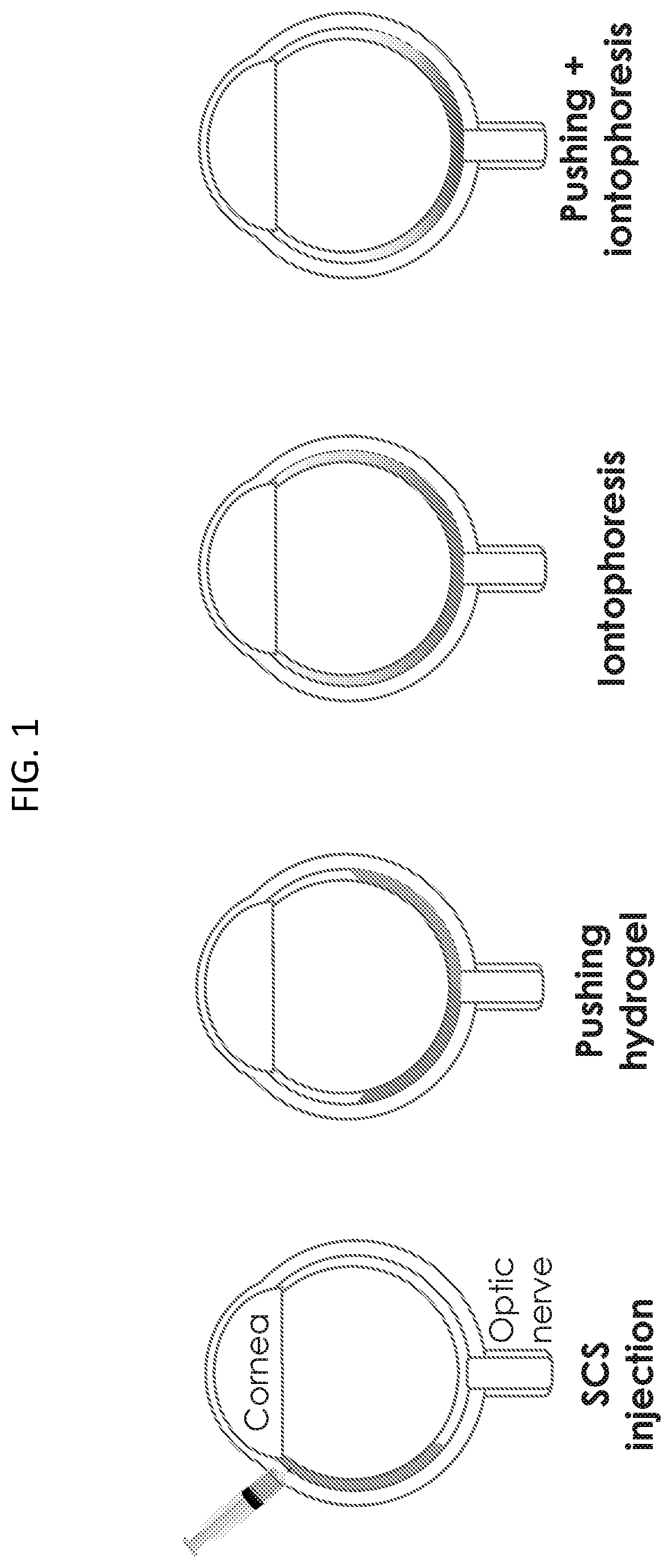 Patent US12090294 Figure 1 – Targeted drug delivery methods using a microneedle