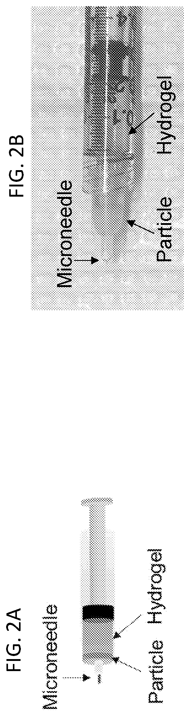 Patent US12090294 Figure 2 – Targeted drug delivery methods using a microneedle
