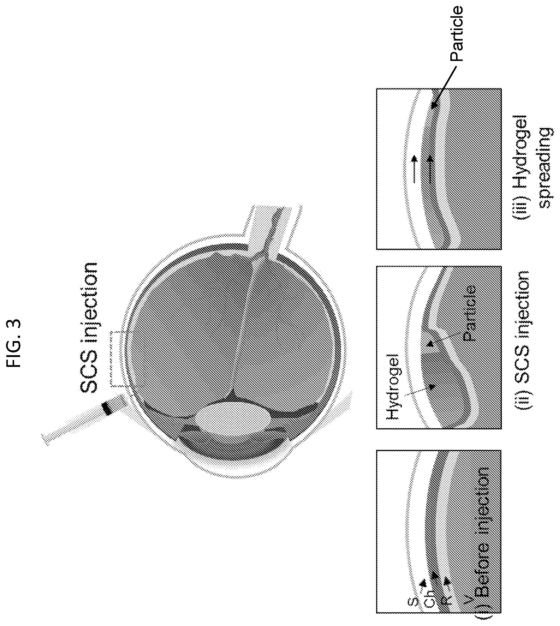 Patent US12090294 Figure 3 – Targeted drug delivery methods using a microneedle
