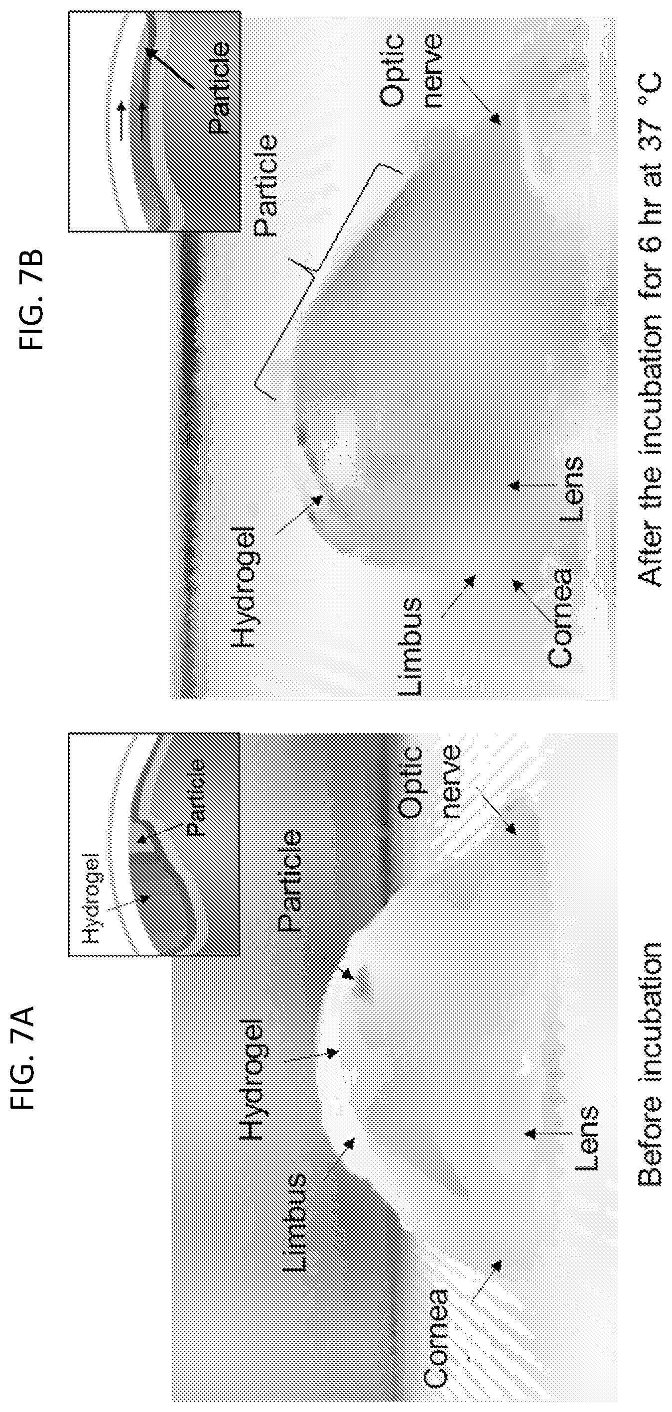 Patent US12090294 Figure 7 – Targeted drug delivery methods using a microneedle
