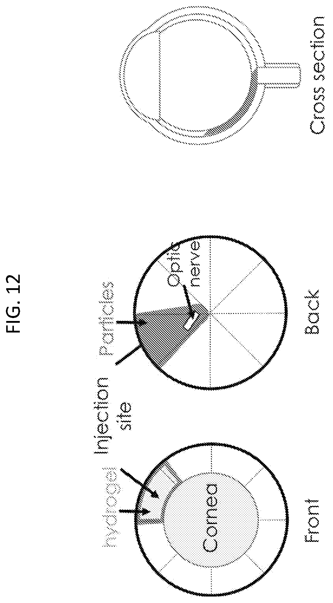 Patent US12090294 Figure 12 – Targeted drug delivery methods using a microneedle
