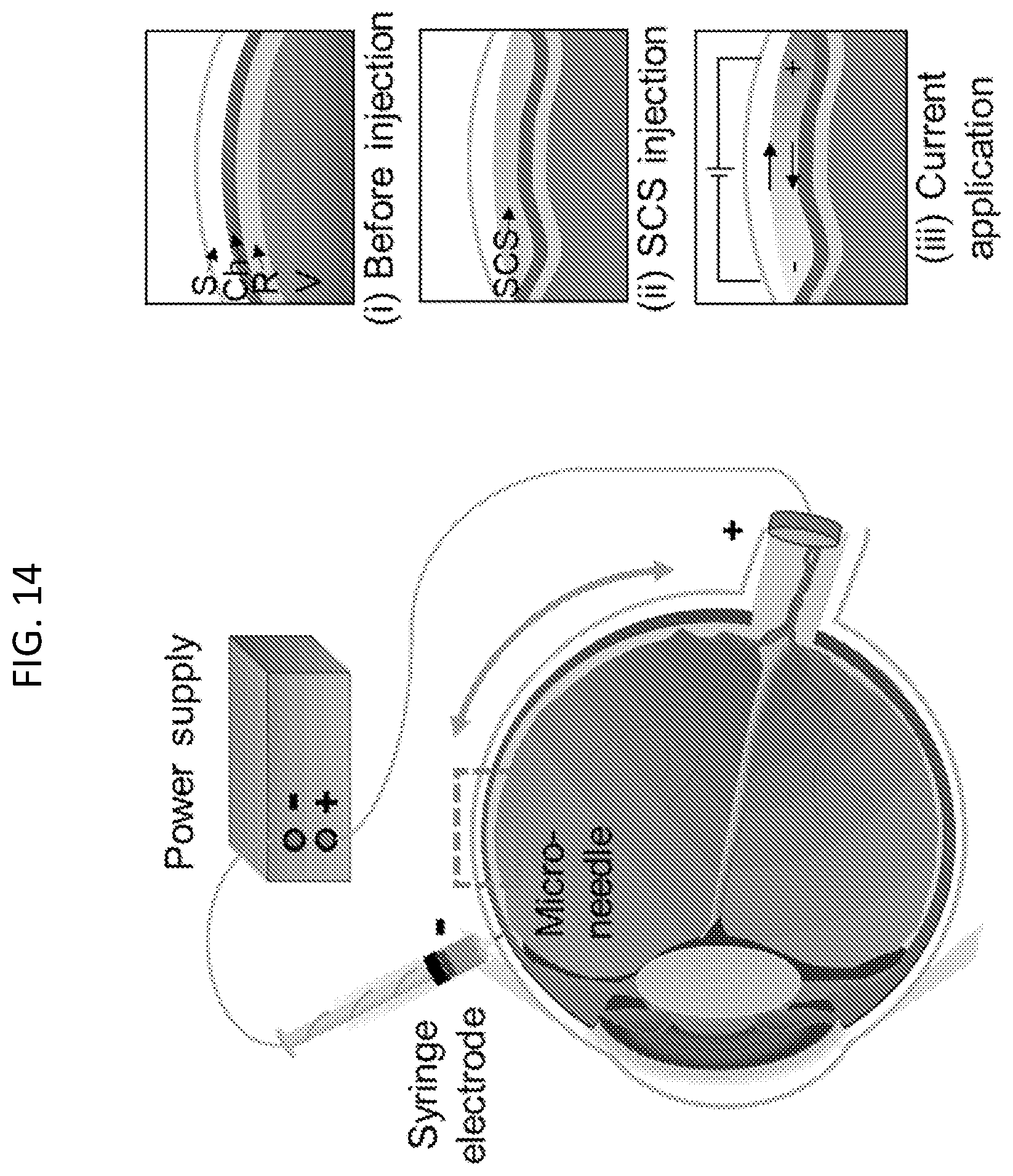 Patent US12090294 Figure 14 – Targeted drug delivery methods using a microneedle