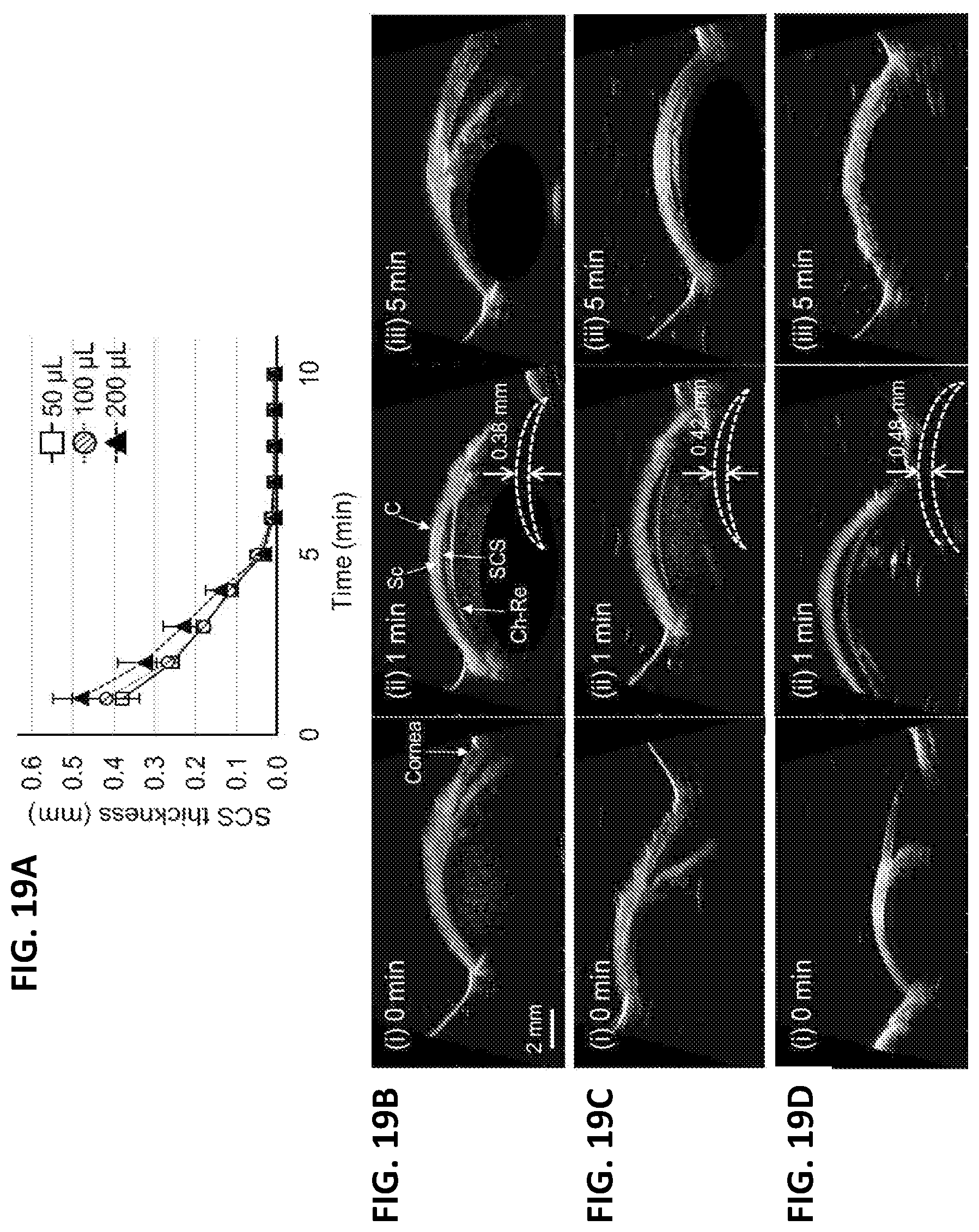 Patent US12090294 Figure 19 – Targeted drug delivery methods using a microneedle