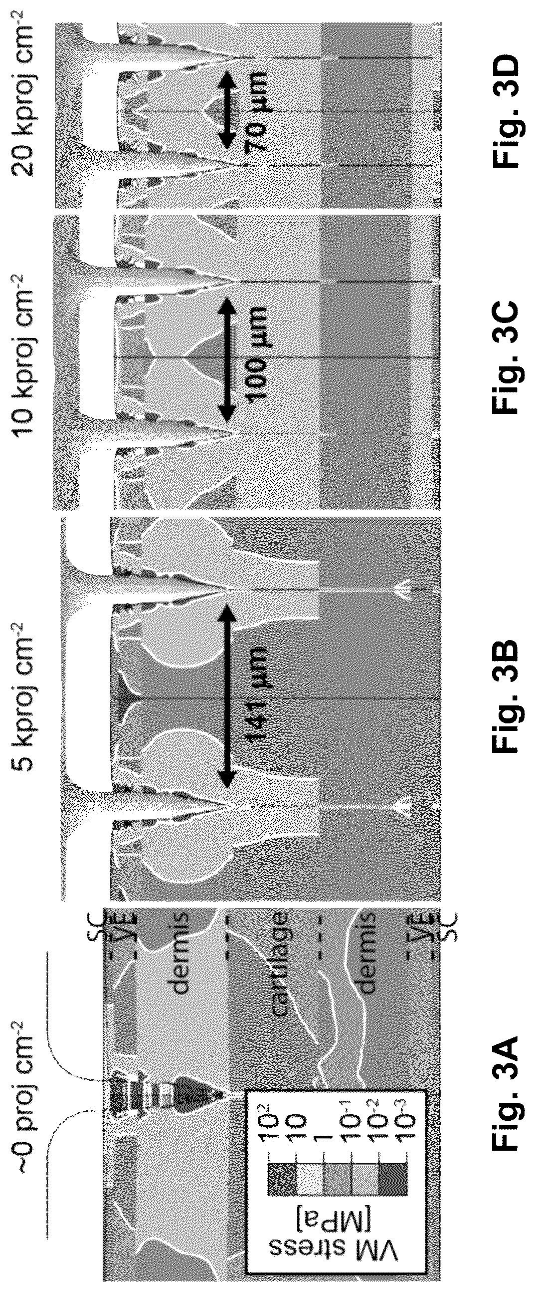 Patent US12090295 Figure 5 – Microprojection arrays with enhanced skin penetrating properties and methods thereof