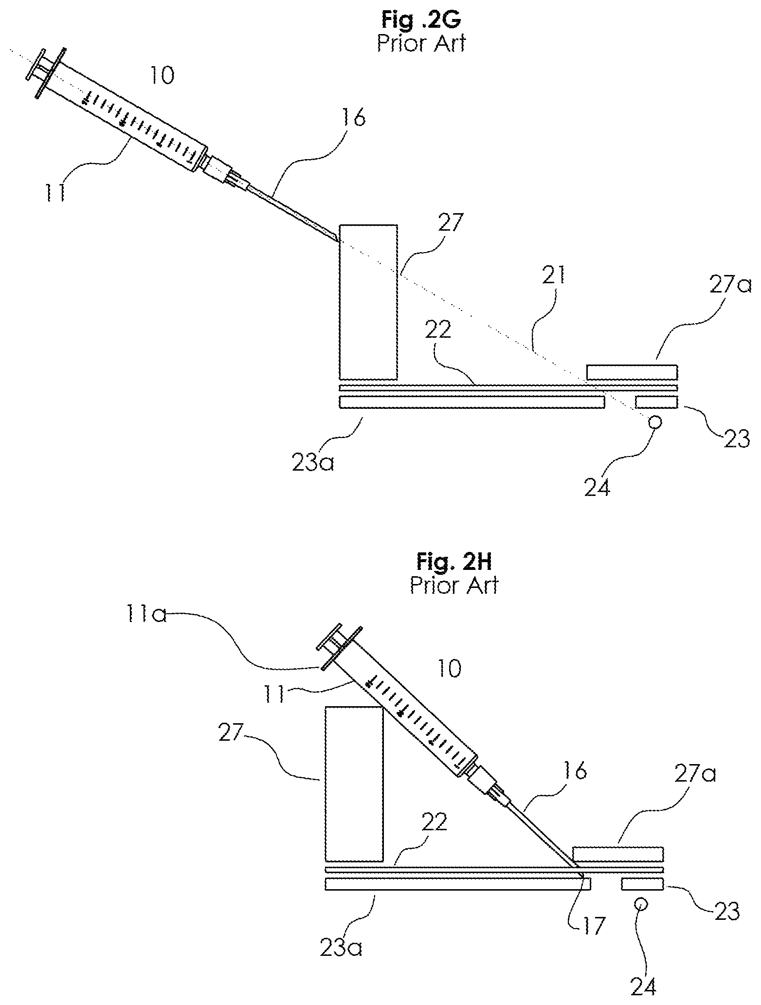Patent US12090309 Figure 4 – Hollow needle and pivotable hub system