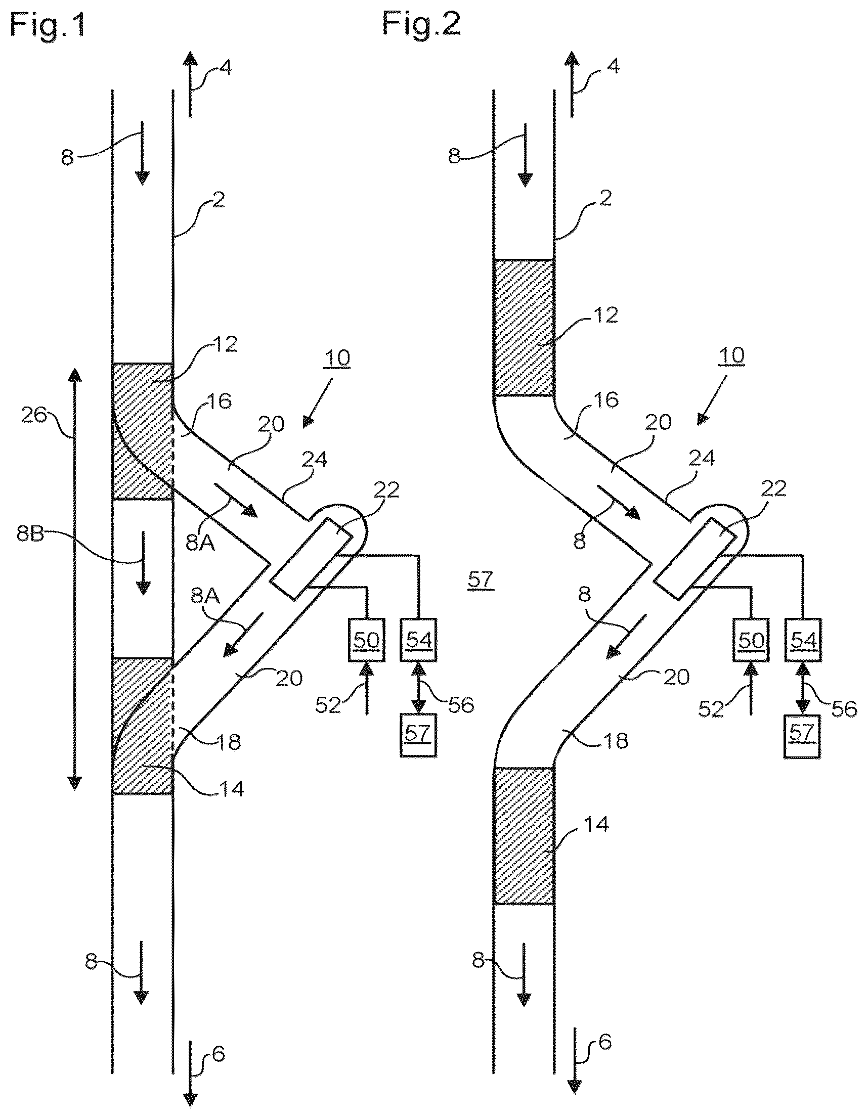 Patent US12090310 Figure 1 – Mechanical circulatory support device with axial flow turbomachine optimized for heart failure and cardio-renal syndrome by implantation in the descending aorta