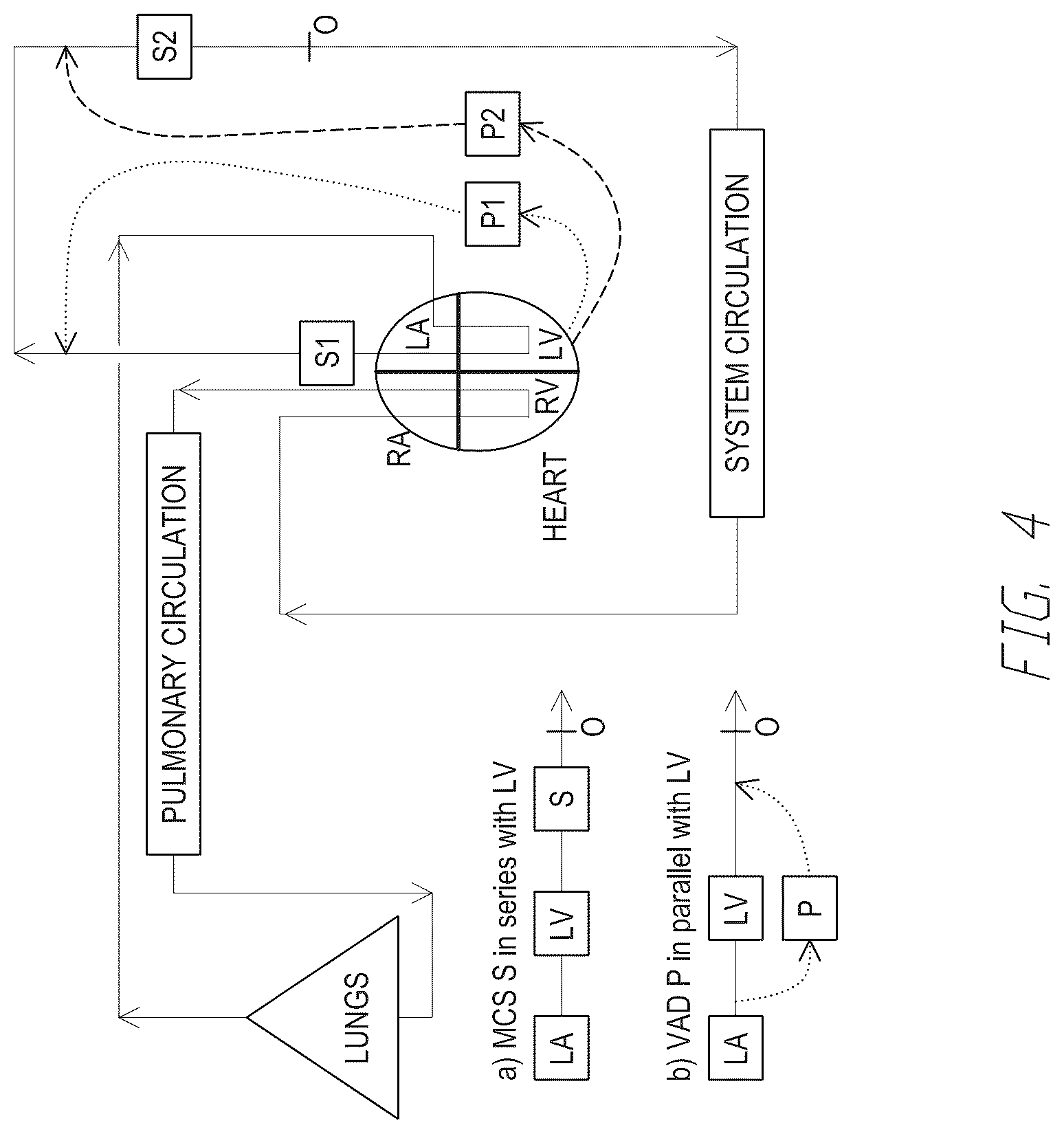 Patent US12090310 Figure 3 – Mechanical circulatory support device with axial flow turbomachine optimized for heart failure and cardio-renal syndrome by implantation in the descending aorta
