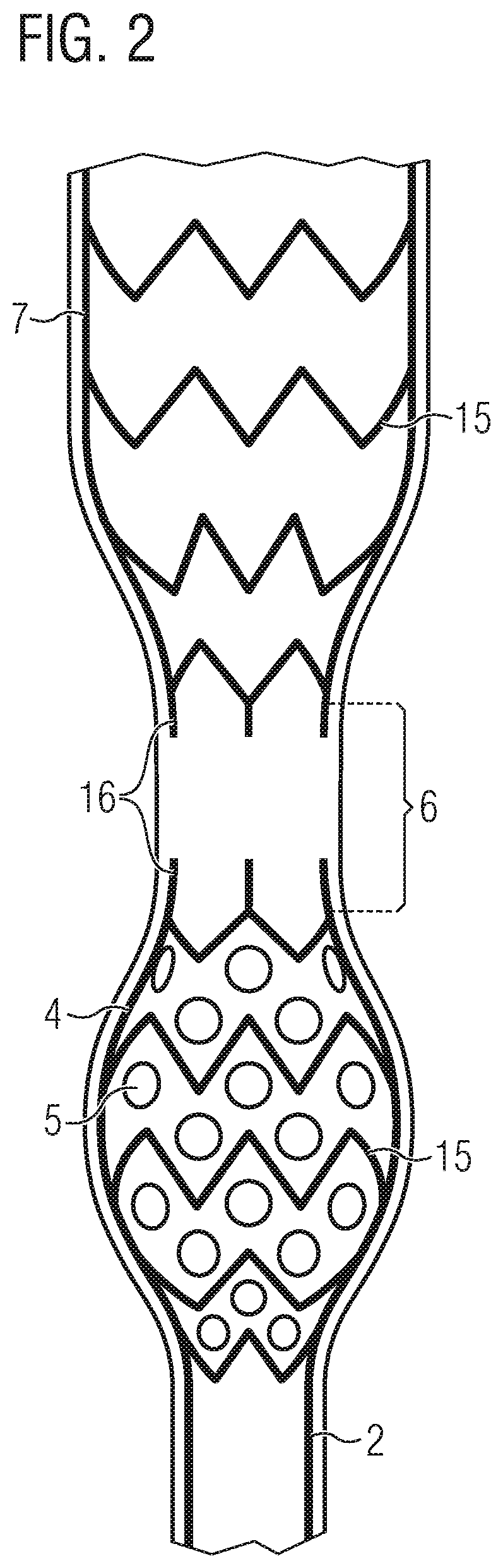 Patent US12090311 Figure 2 – Pump catheter for the directed pulsatile conveying of blood