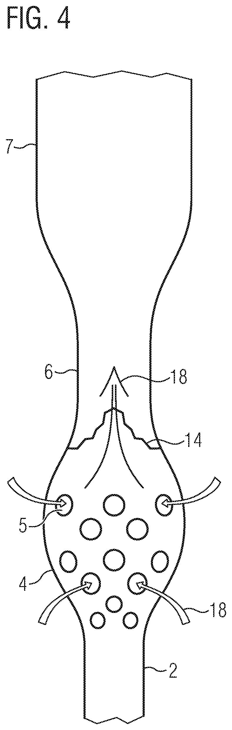 Patent US12090311 Figure 4 – Pump catheter for the directed pulsatile conveying of blood