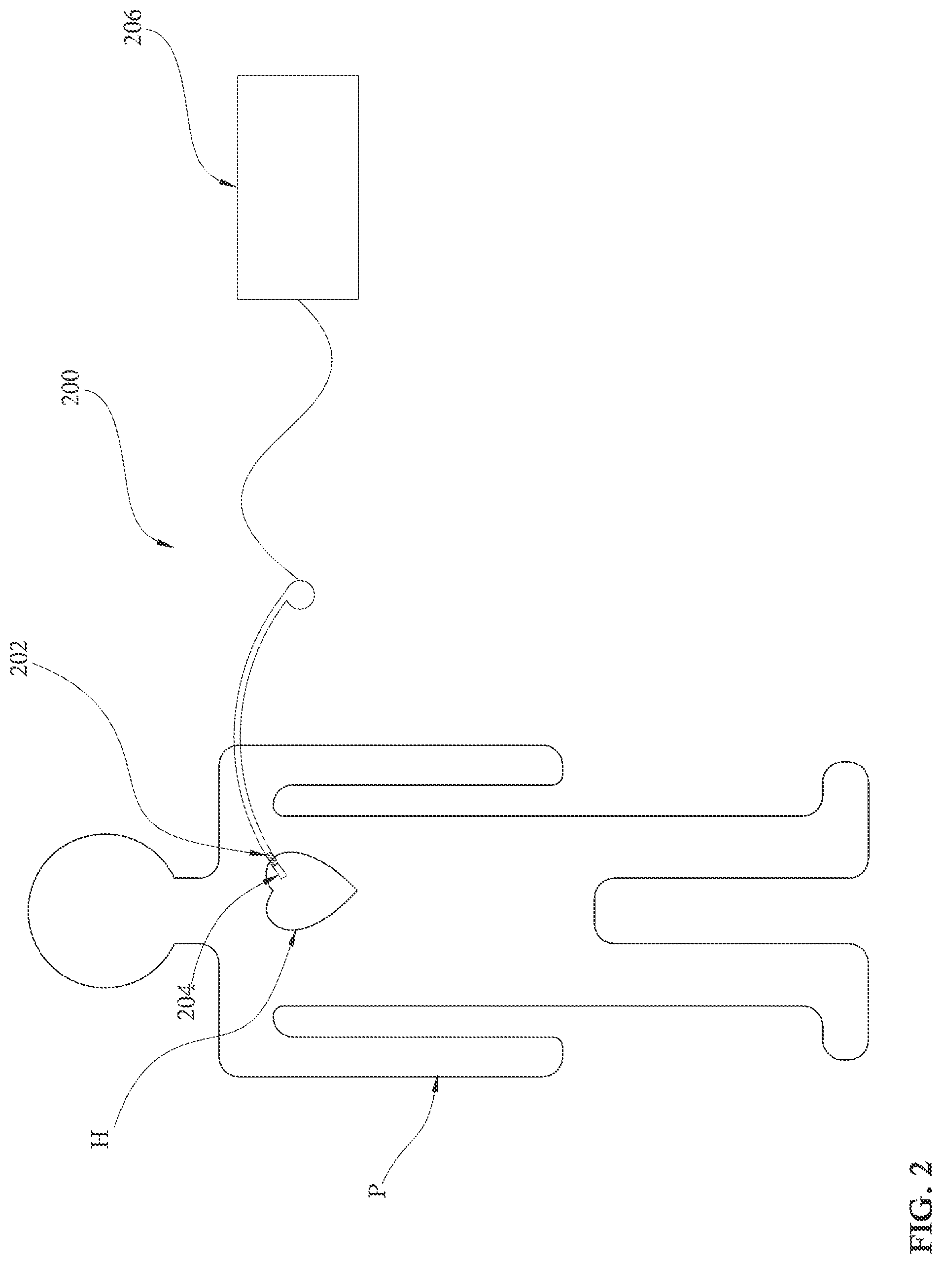 Patent US12090313 Figure 2 – Expandable mechanical hemodynamic support systems, devices, and methods