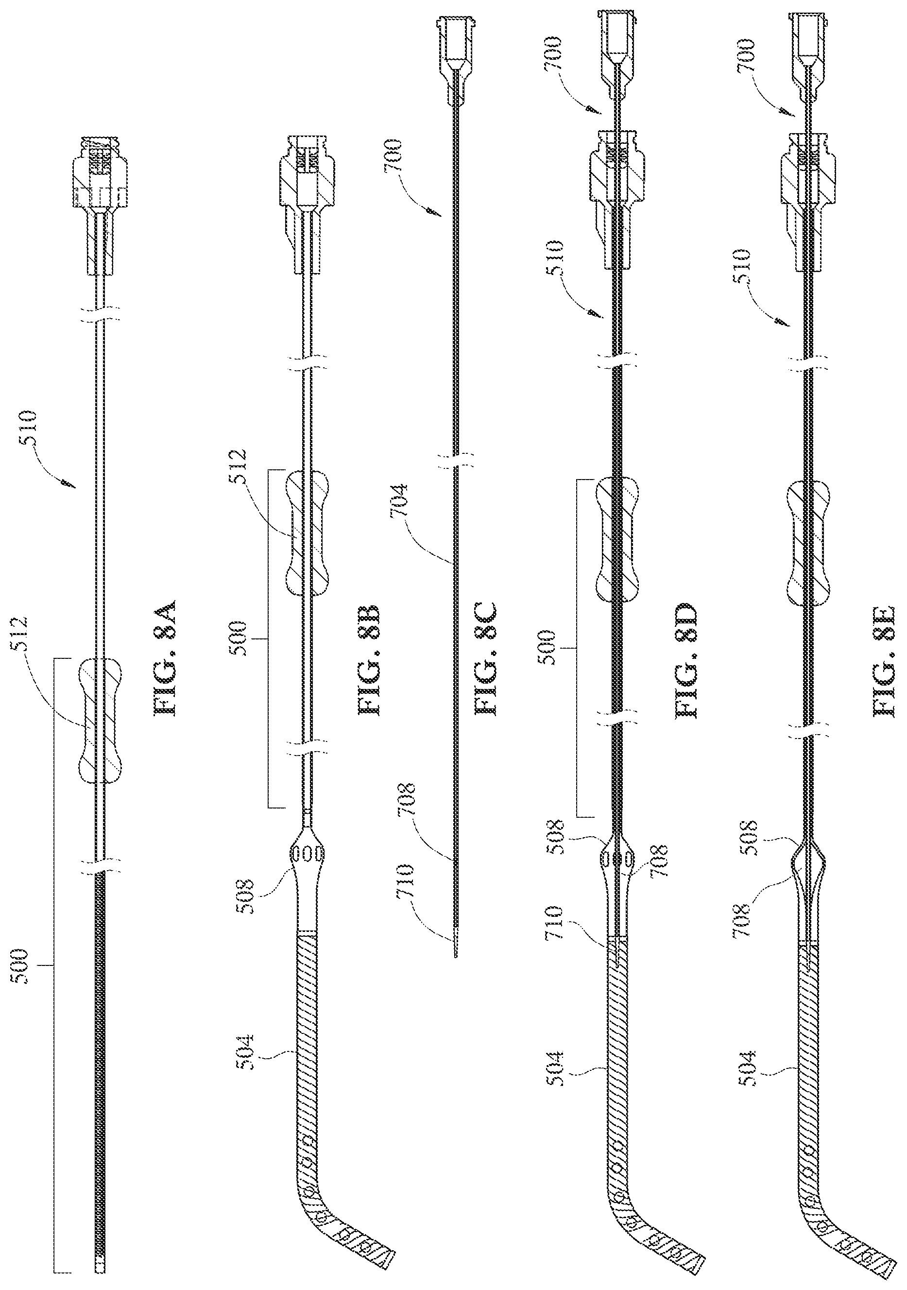 Patent US12090313 Figure 9 – Expandable mechanical hemodynamic support systems, devices, and methods