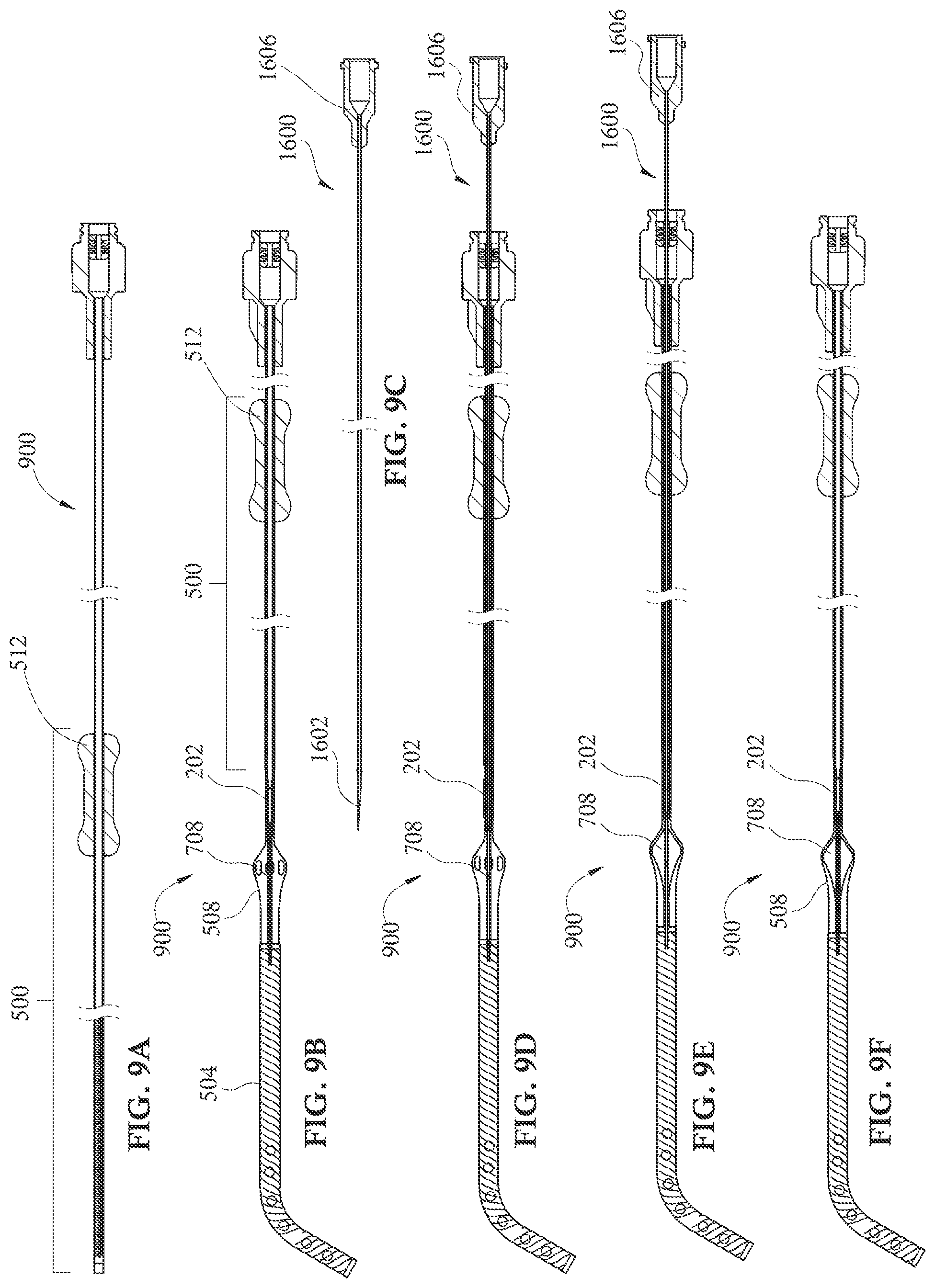 Patent US12090313 Figure 10 – Expandable mechanical hemodynamic support systems, devices, and methods