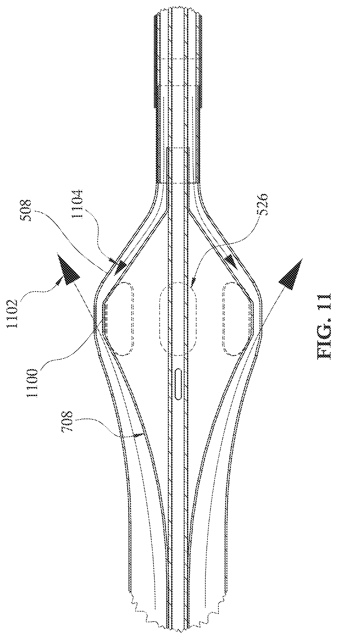Patent US12090313 Figure 12 – Expandable mechanical hemodynamic support systems, devices, and methods