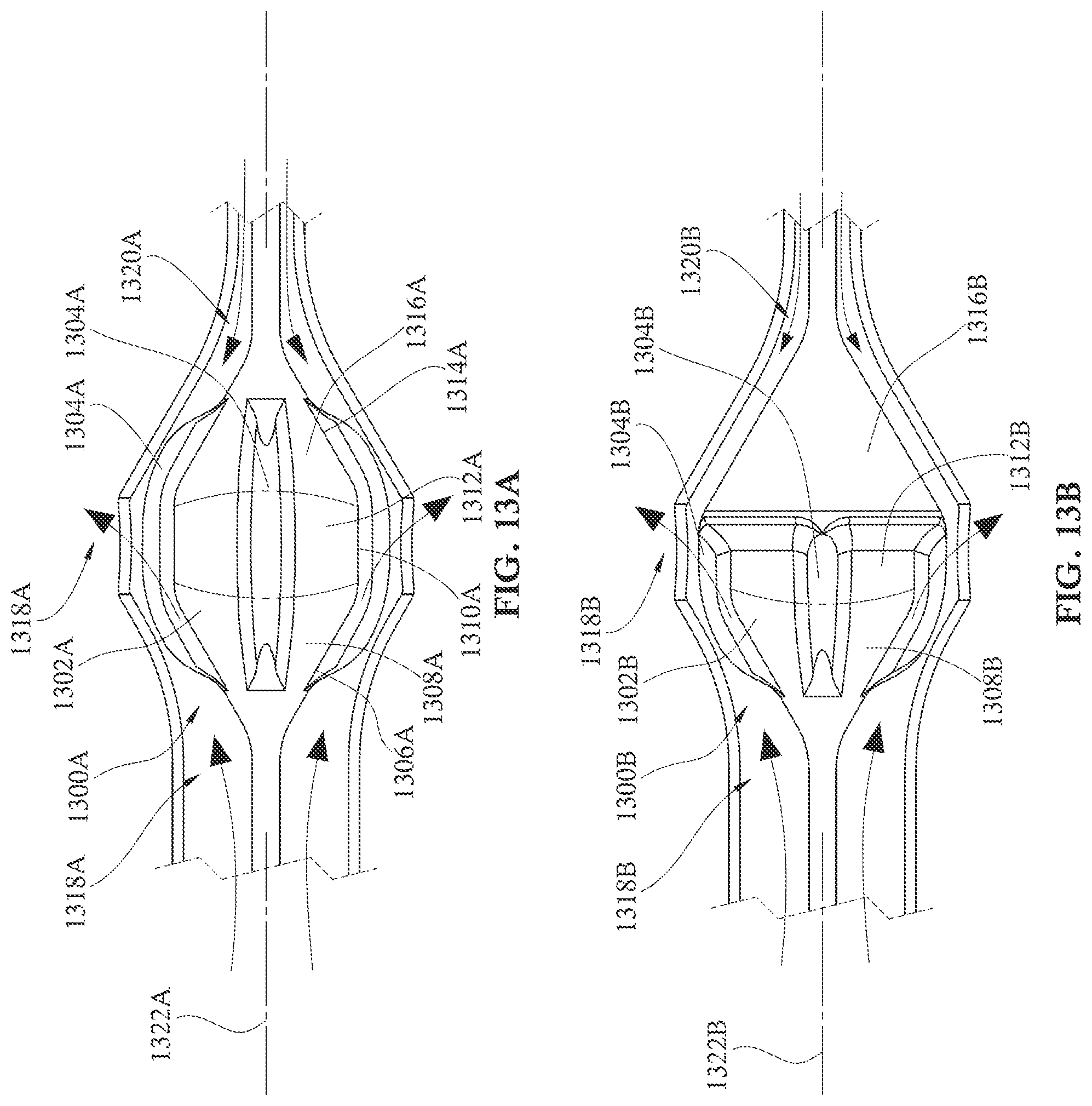 Patent US12090313 Figure 14 – Expandable mechanical hemodynamic support systems, devices, and methods