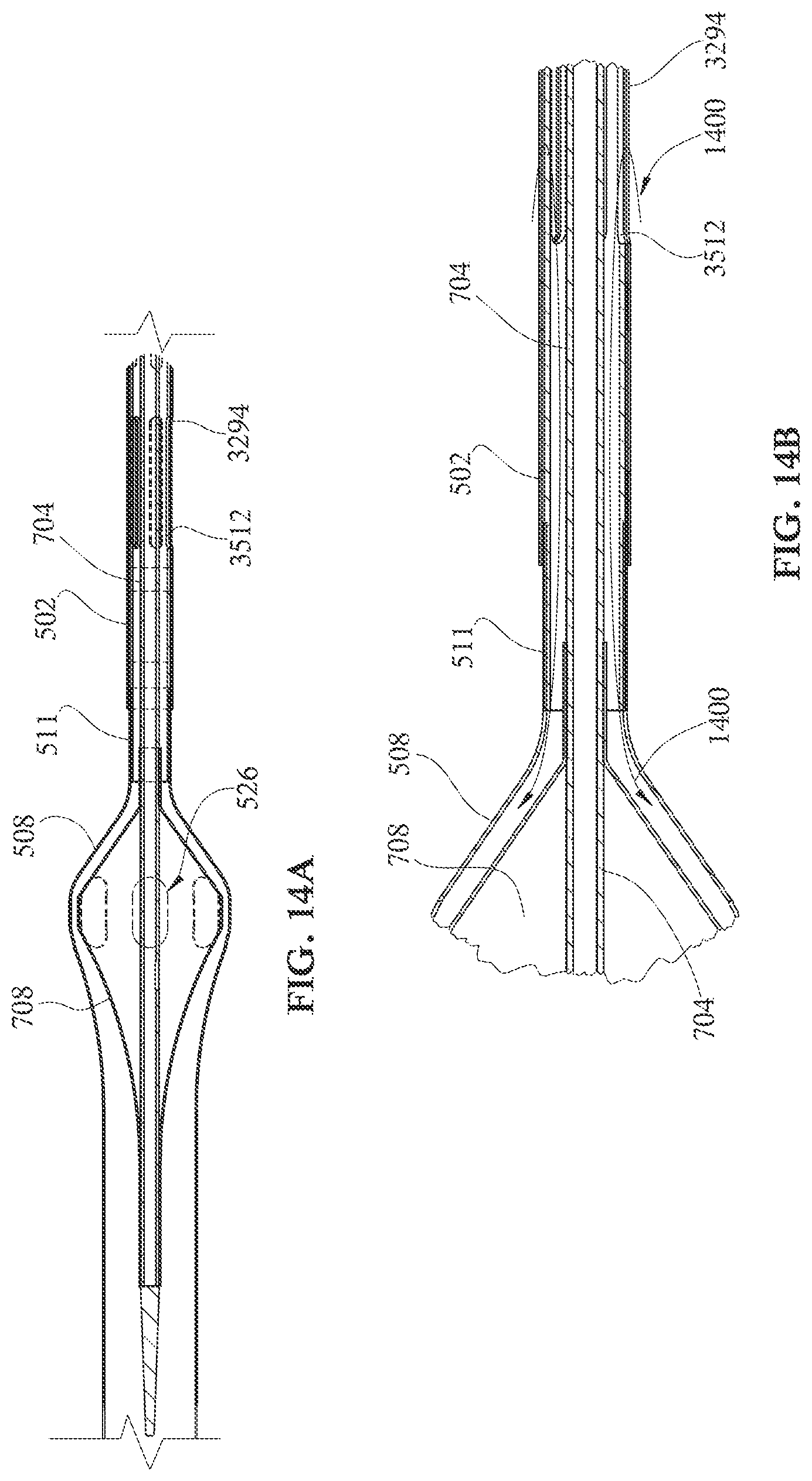 Patent US12090313 Figure 15 – Expandable mechanical hemodynamic support systems, devices, and methods