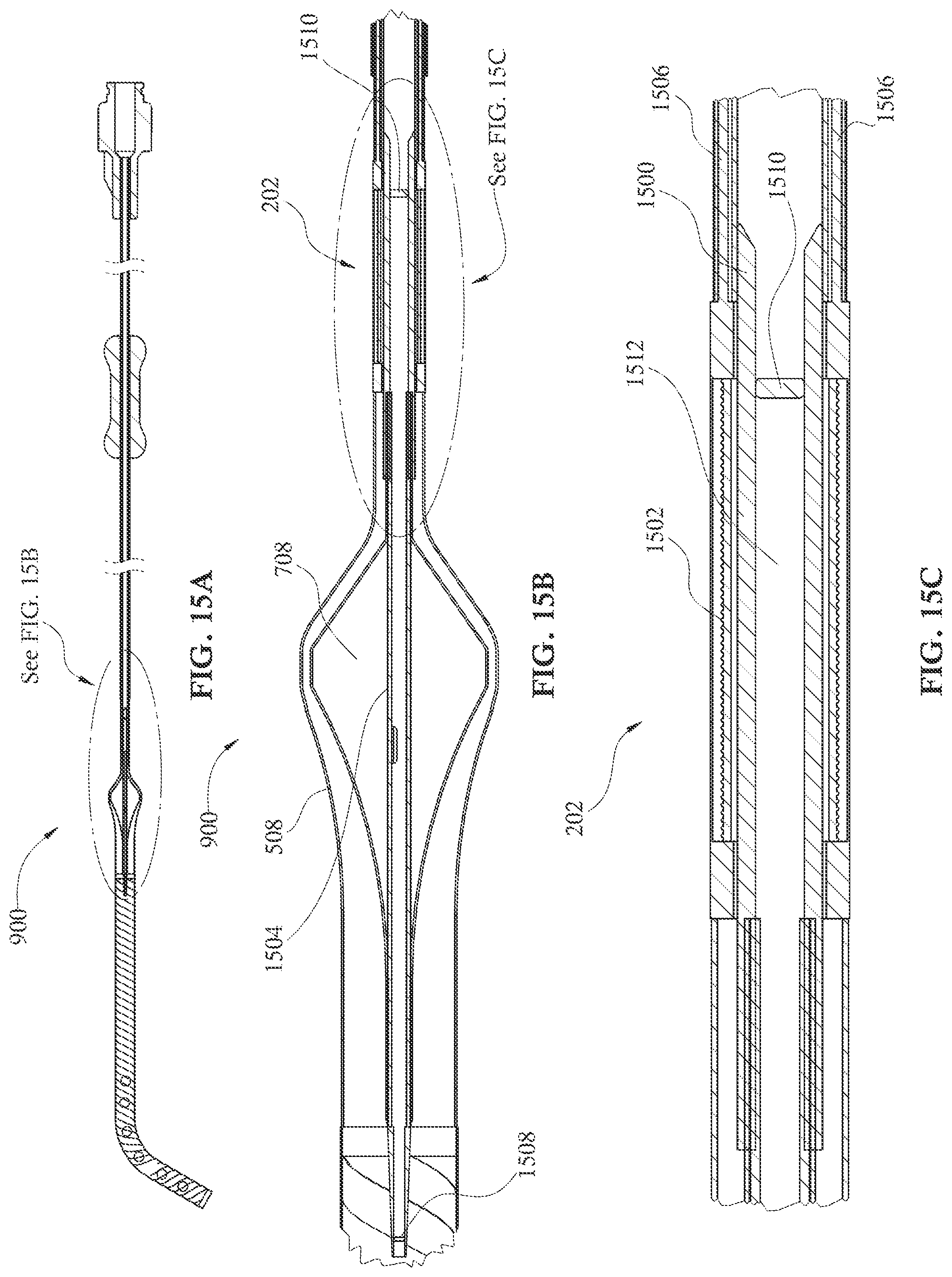 Patent US12090313 Figure 16 – Expandable mechanical hemodynamic support systems, devices, and methods