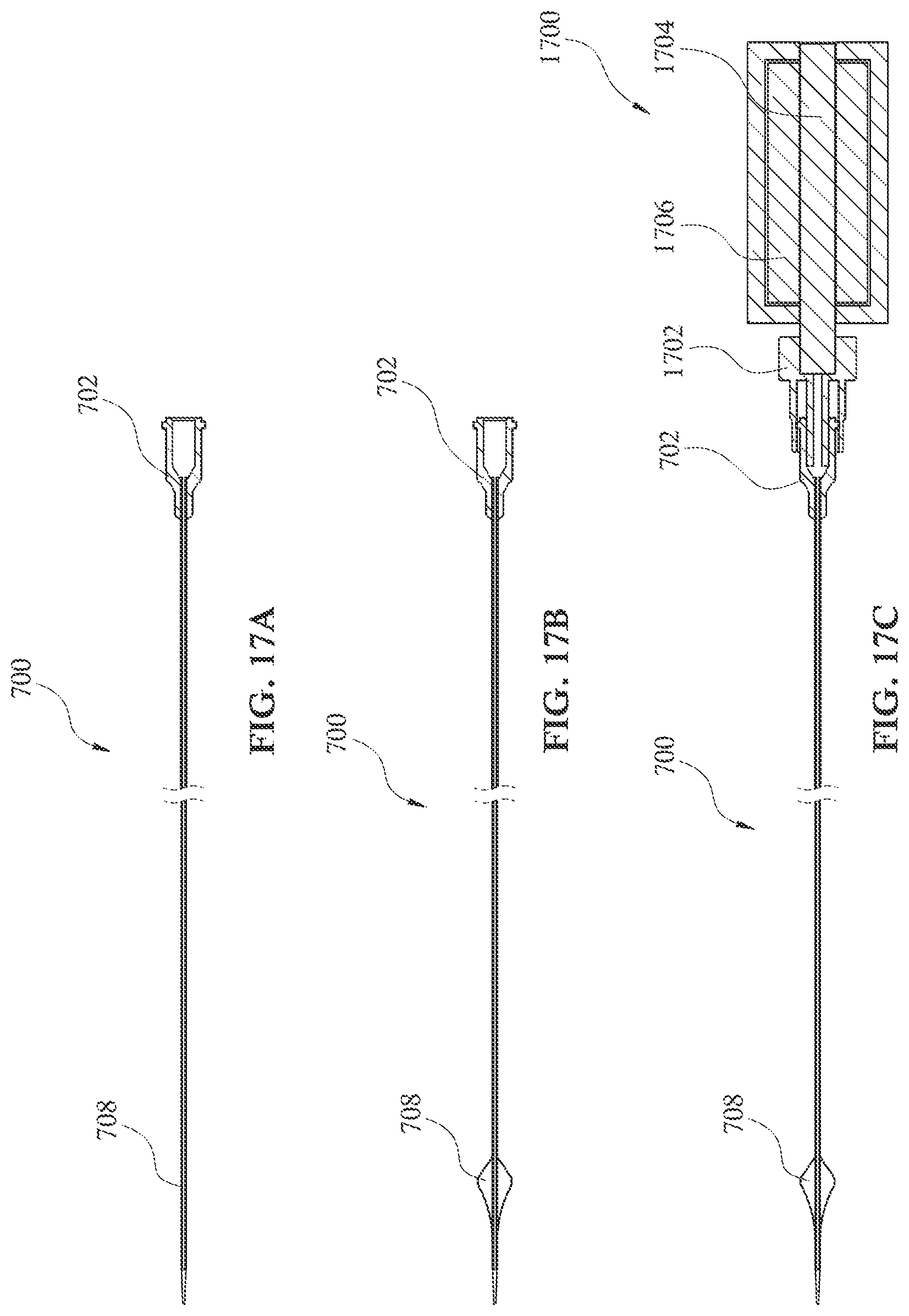 Patent US12090313 Figure 18 – Expandable mechanical hemodynamic support systems, devices, and methods