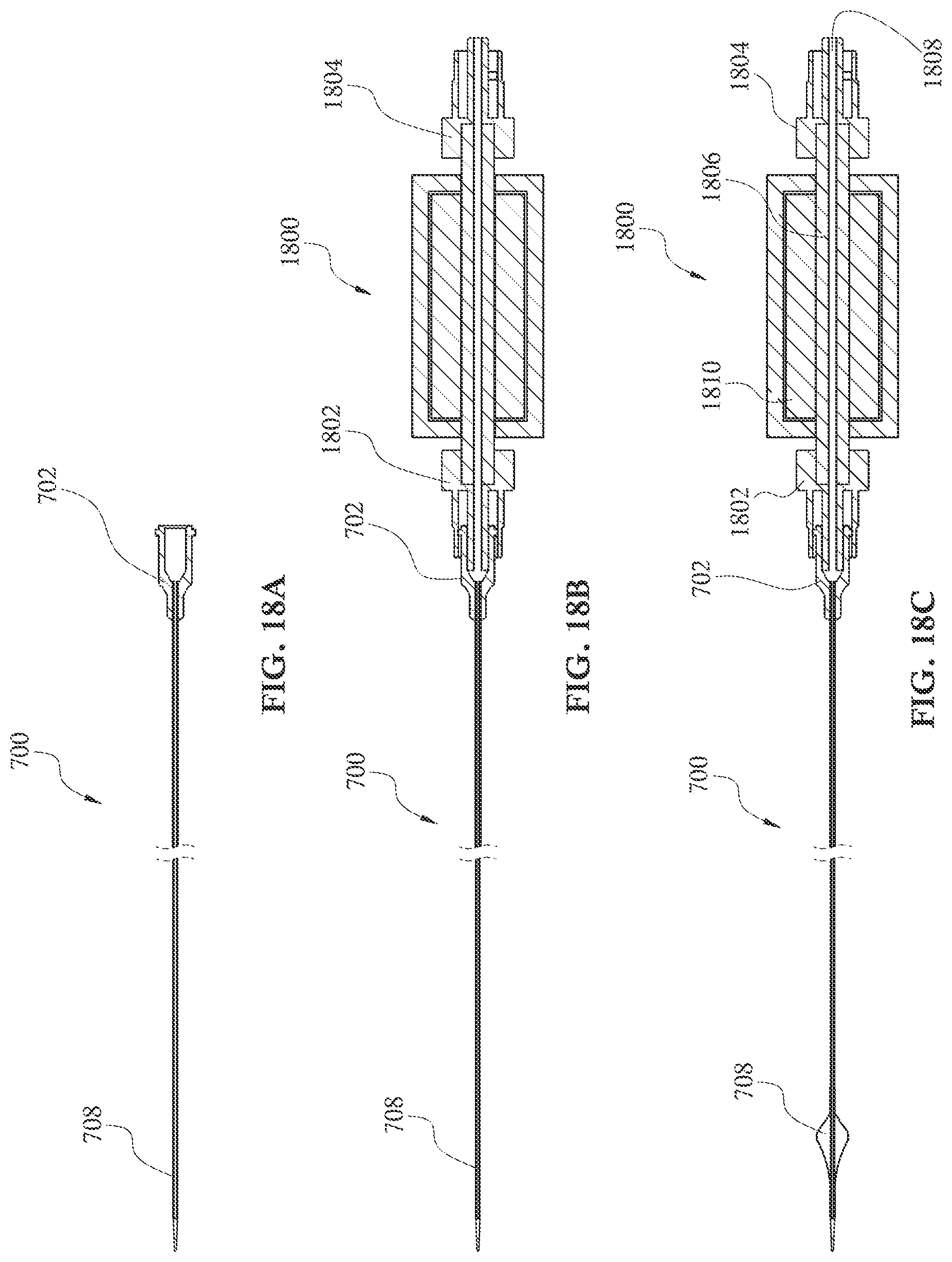 Patent US12090313 Figure 19 – Expandable mechanical hemodynamic support systems, devices, and methods