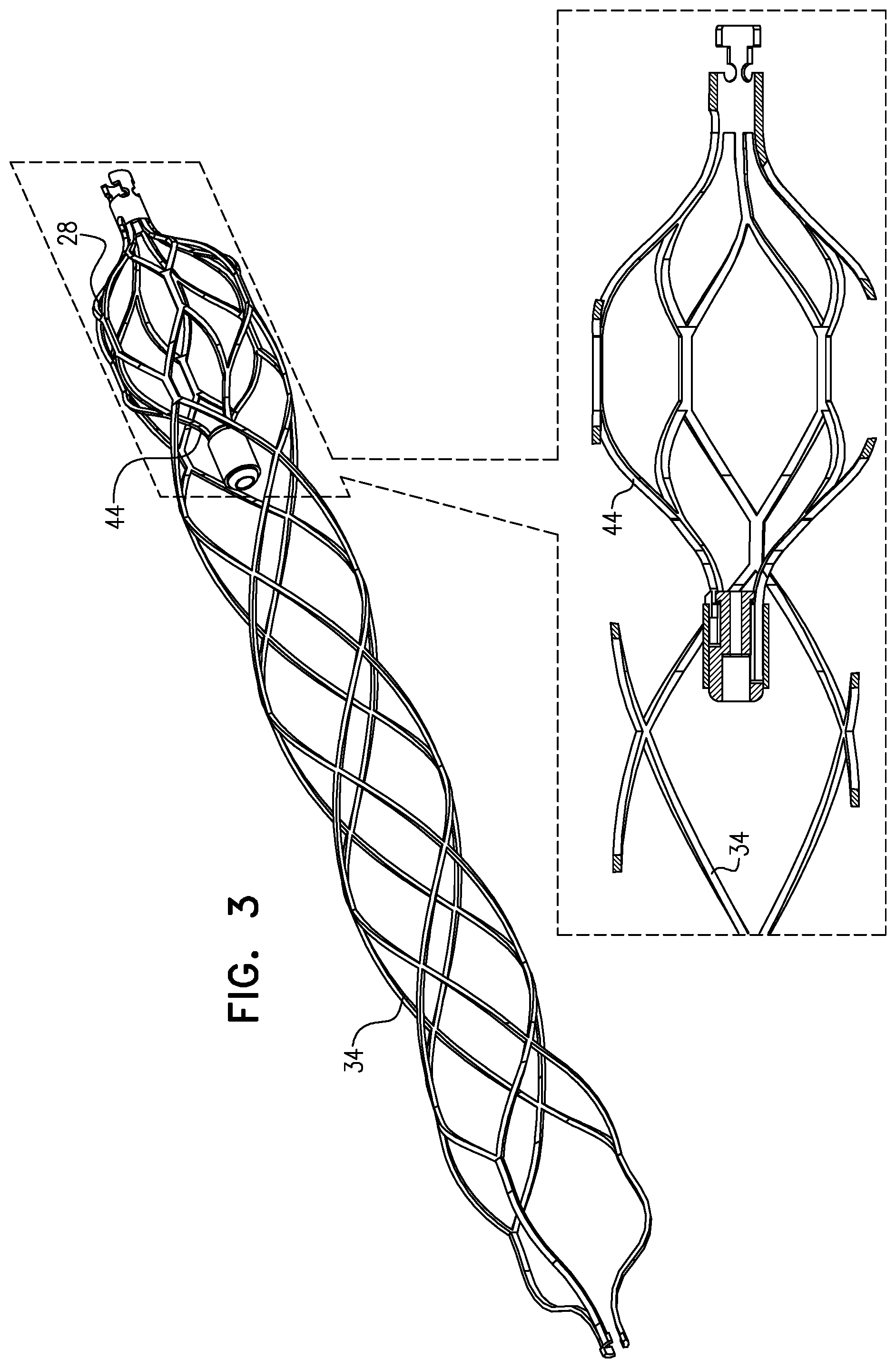 Patent US12090314 Figure 3 – Ventricular assist device