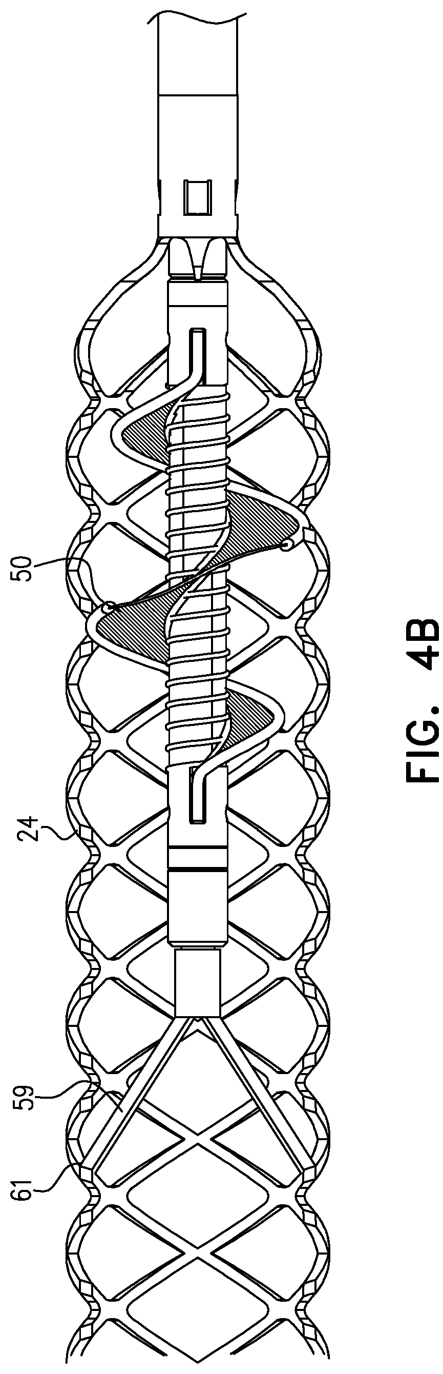 Patent US12090314 Figure 5 – Ventricular assist device