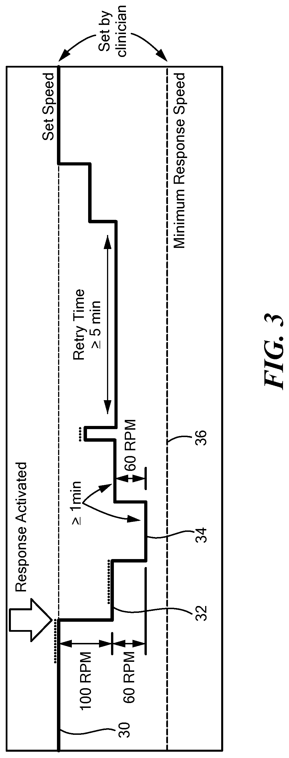 Patent US12090315 Figure 3 – Speed change algorithm to resolve suction conditions in LVADS