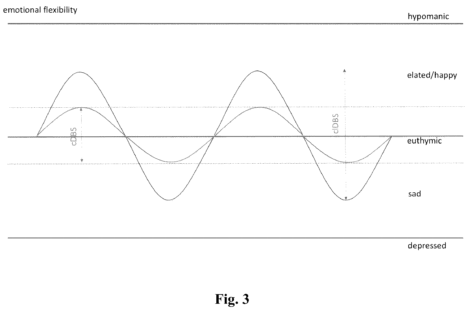 Patent US12090317 Figure 3 – Adaptive deep brain stimulation of the superolateral medial forebrain bundle
