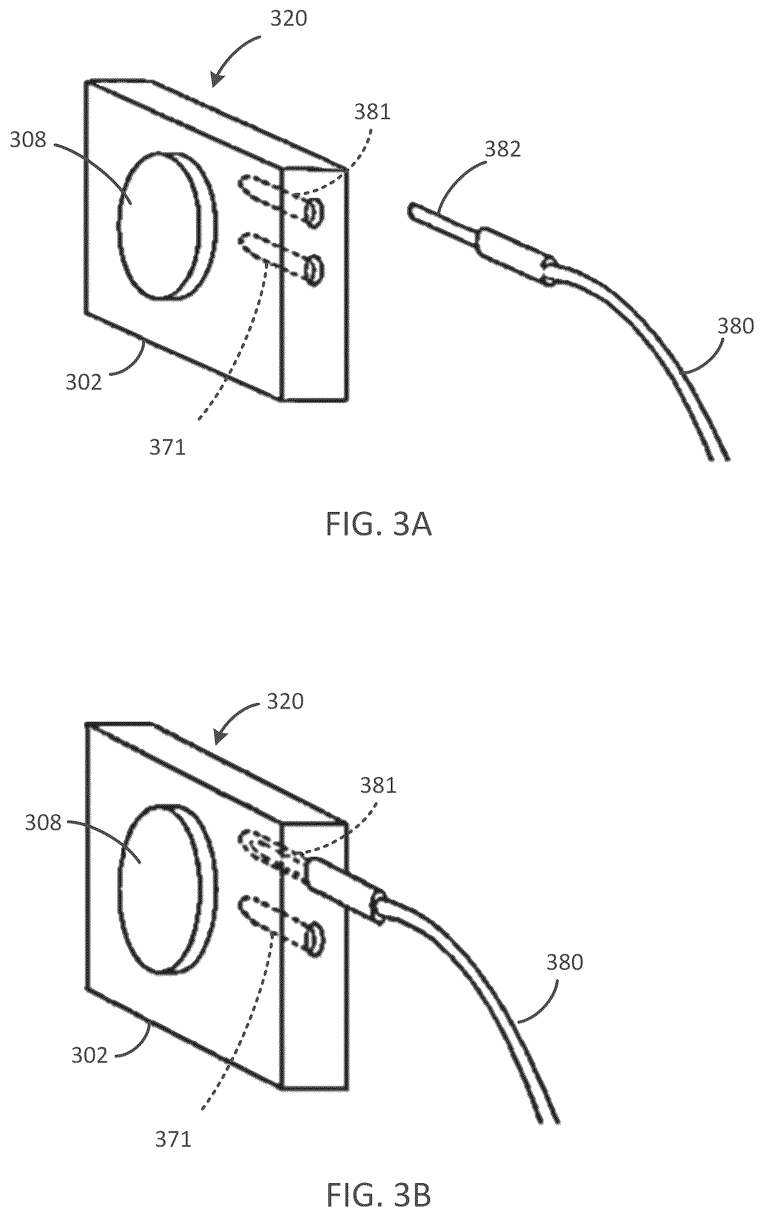 Patent US12090318 Figure 3 – Implantable cochlear system with integrated components and lead characterization