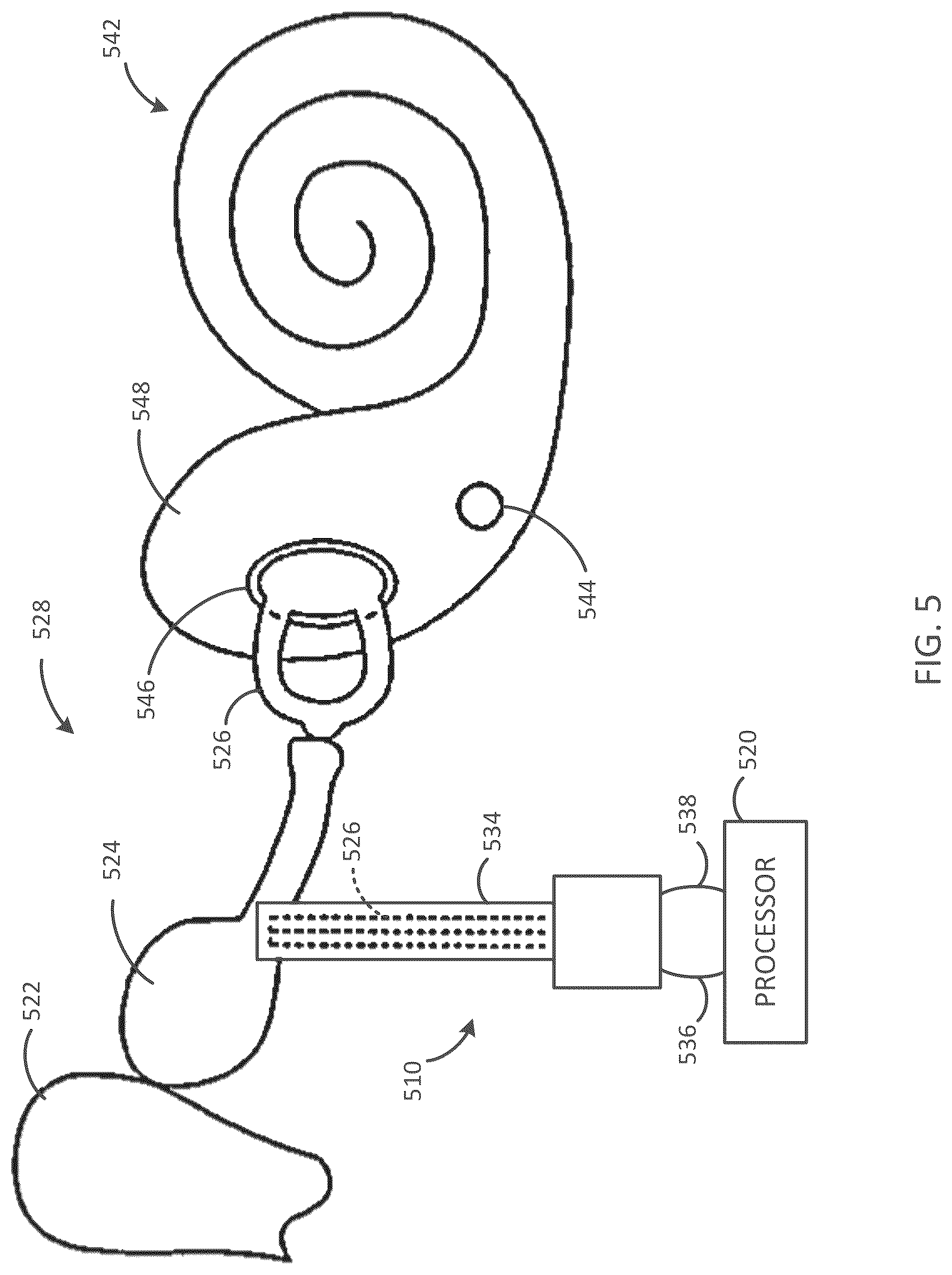 Patent US12090318 Figure 5 – Implantable cochlear system with integrated components and lead characterization