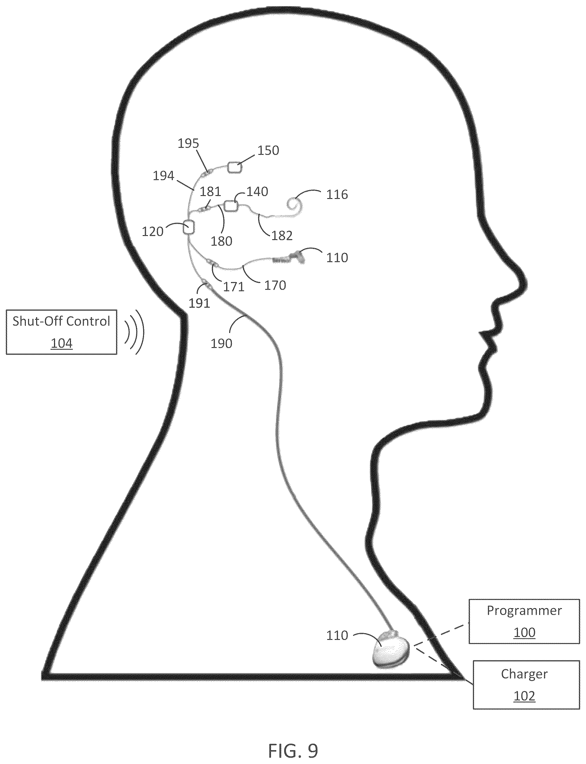 Patent US12090318 Figure 9 – Implantable cochlear system with integrated components and lead characterization