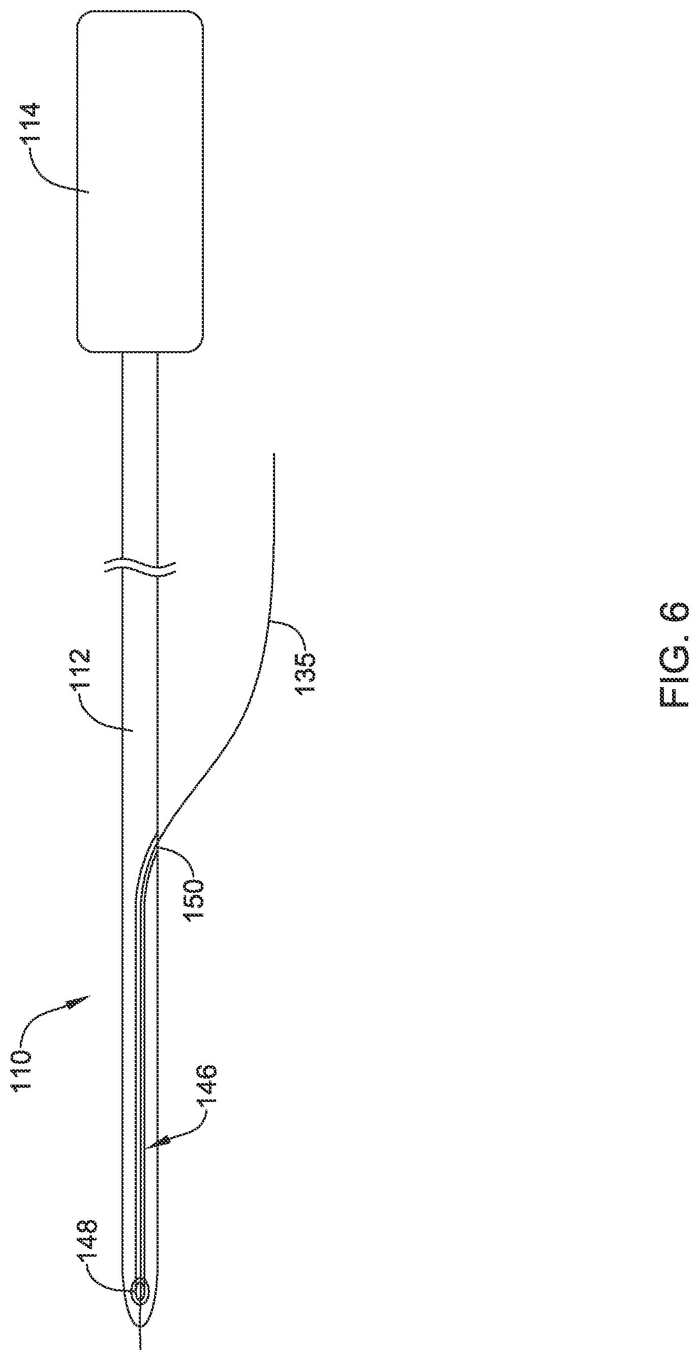 Patent US12090319 Figure 6 – Implantable medical devices and methods for making and delivering implantable medical devices