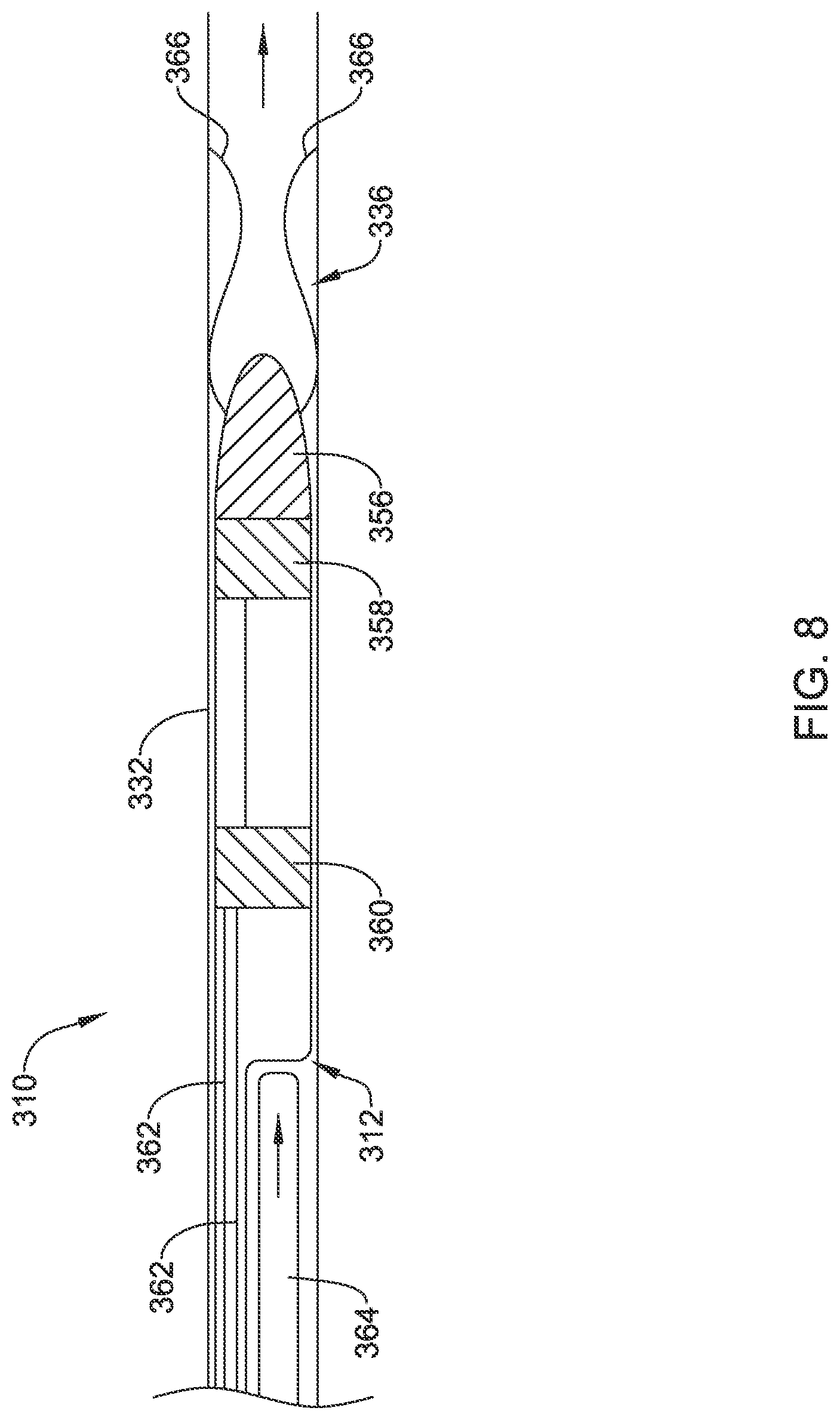 Patent US12090319 Figure 8 – Implantable medical devices and methods for making and delivering implantable medical devices