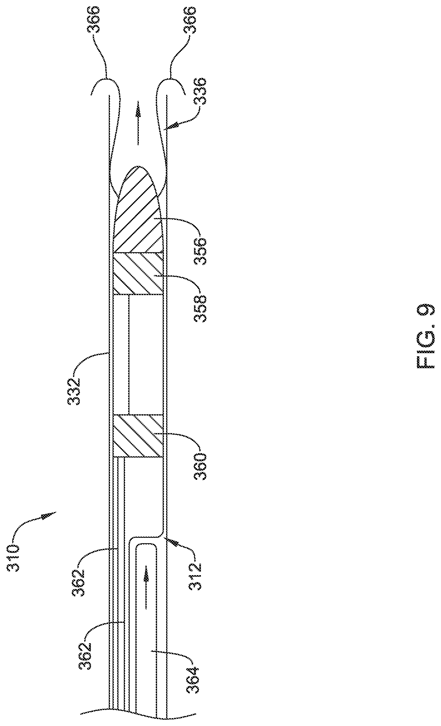Patent US12090319 Figure 9 – Implantable medical devices and methods for making and delivering implantable medical devices