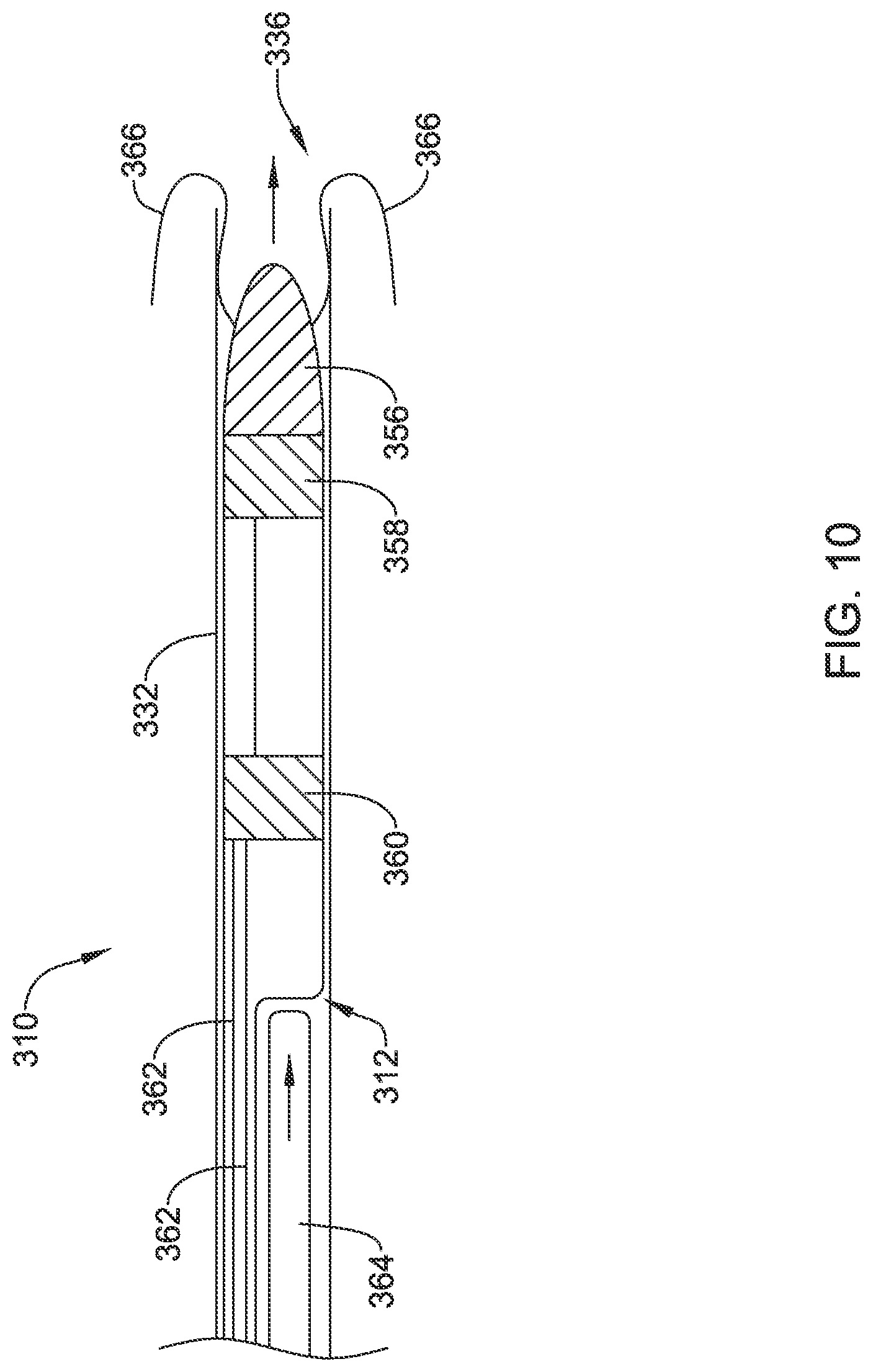 Patent US12090319 Figure 10 – Implantable medical devices and methods for making and delivering implantable medical devices