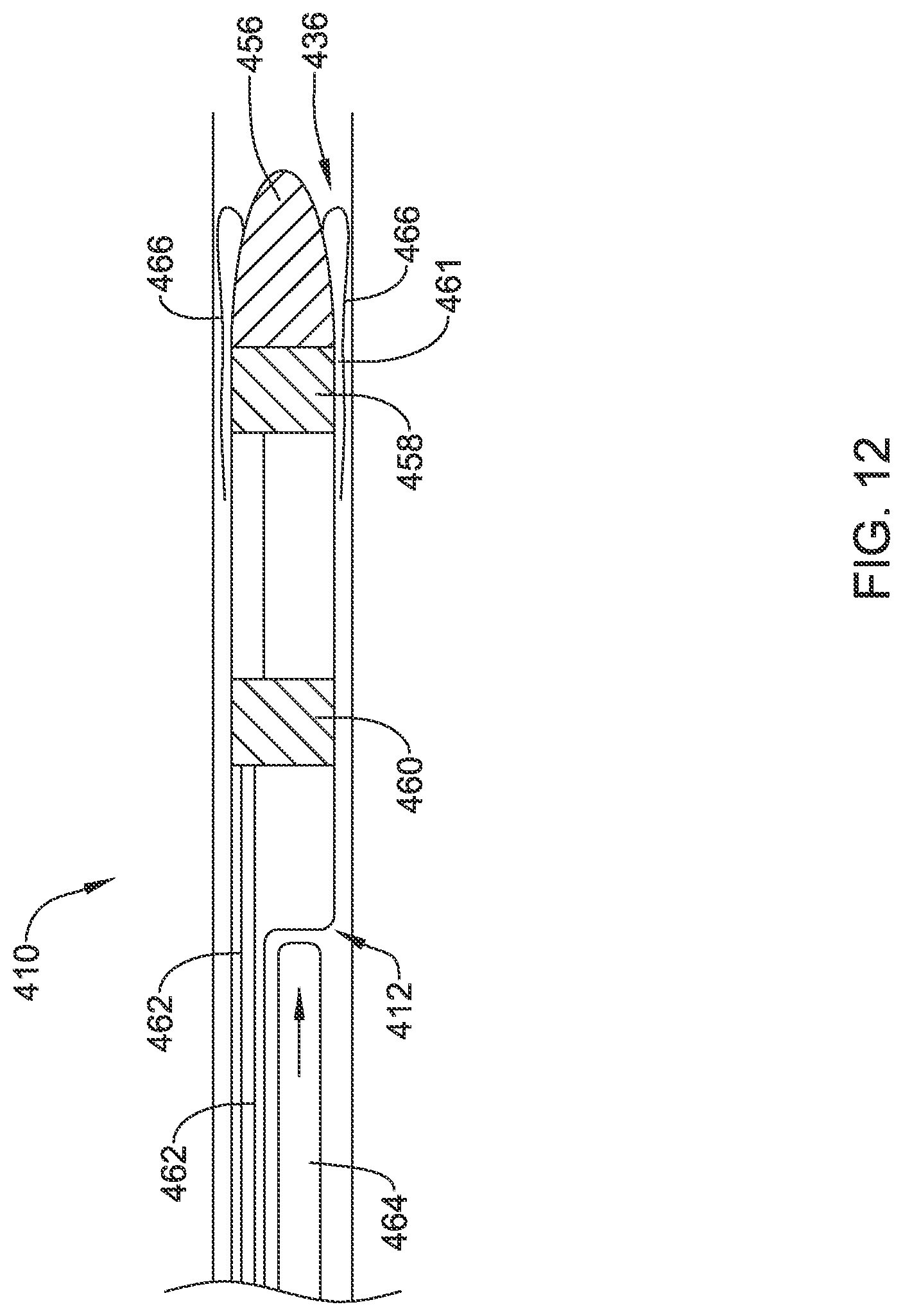 Patent US12090319 Figure 12 – Implantable medical devices and methods for making and delivering implantable medical devices