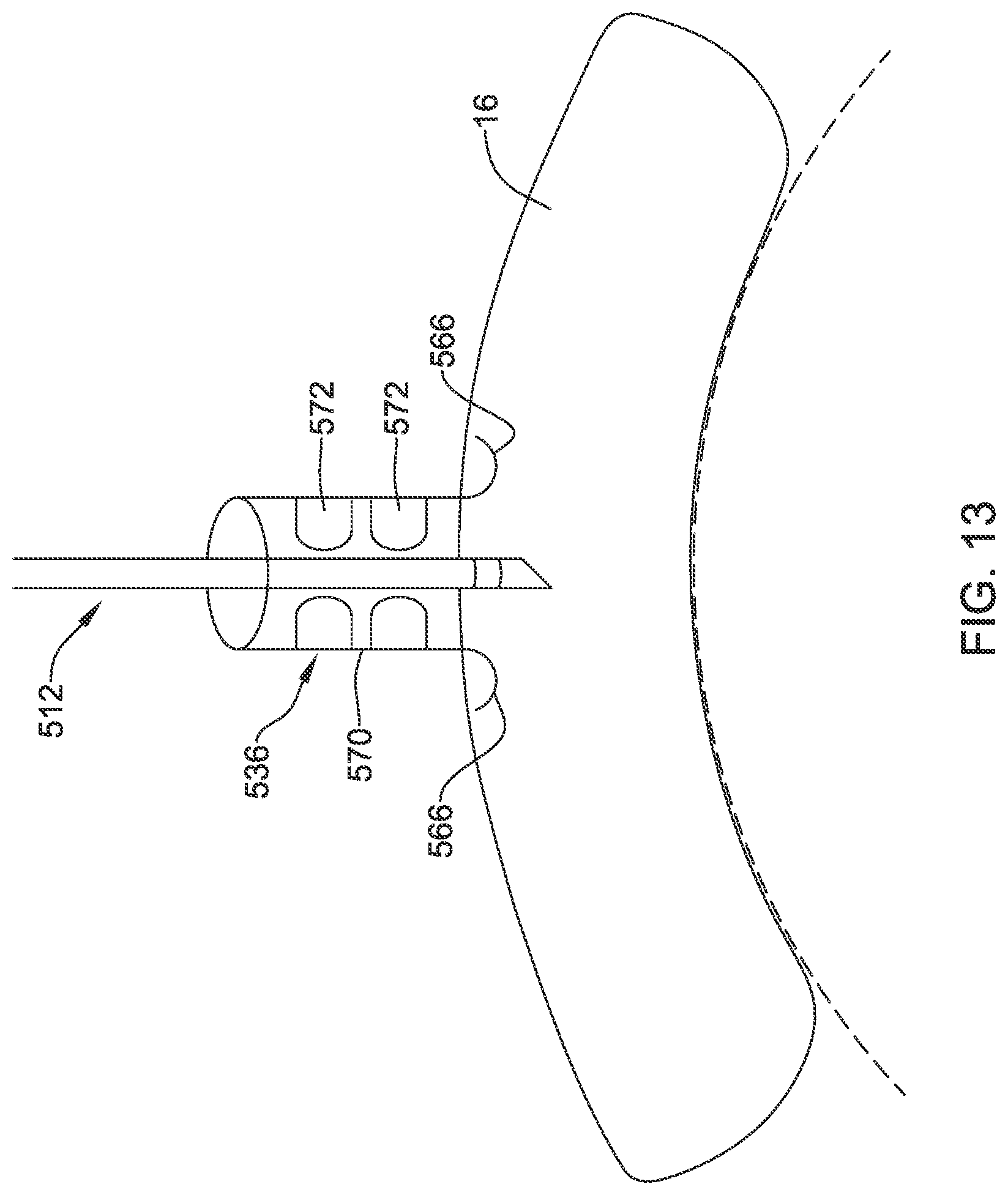 Patent US12090319 Figure 13 – Implantable medical devices and methods for making and delivering implantable medical devices