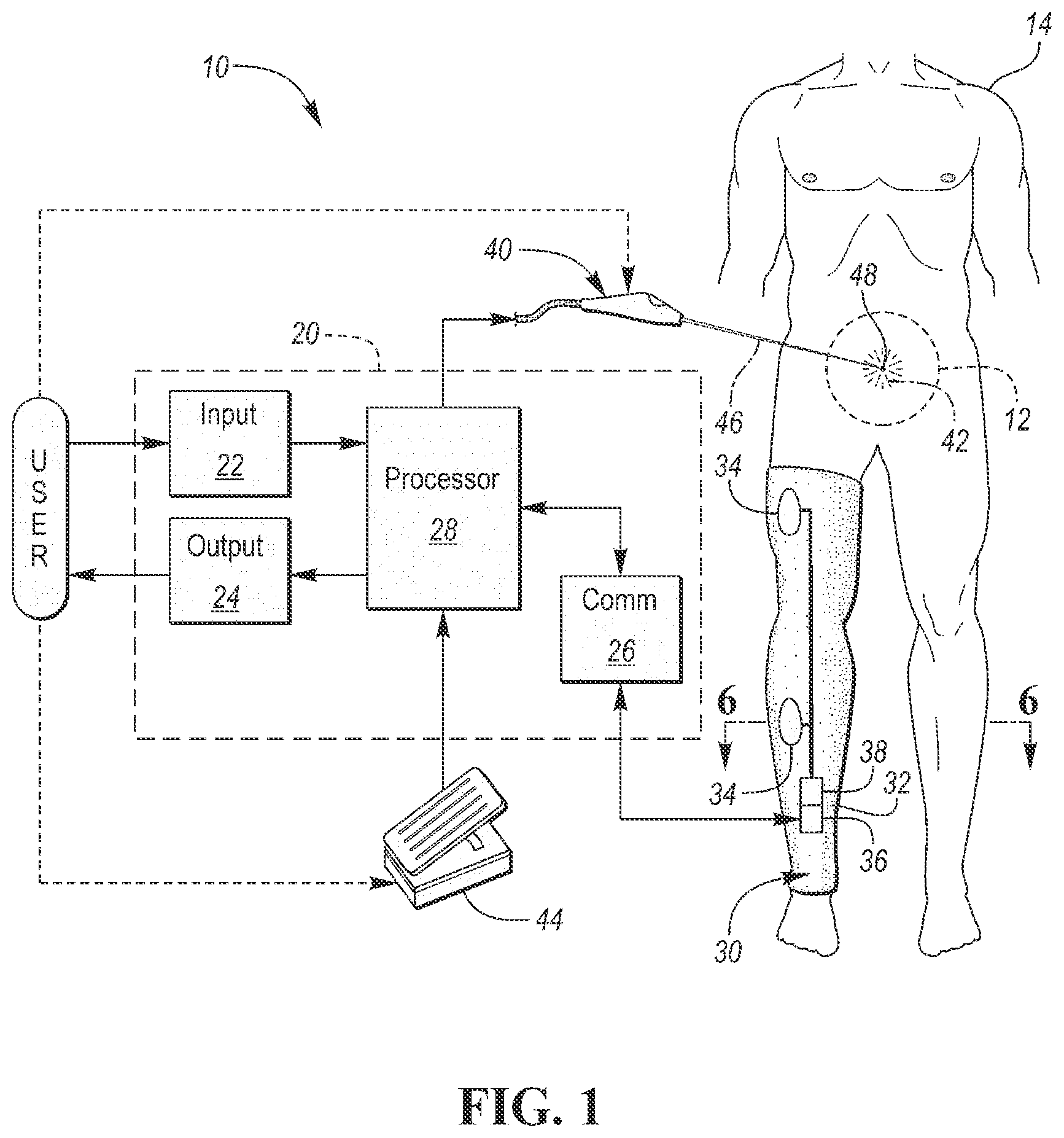 Patent US12090320 — Neuromuscular sensing device with multi-sensor array — Figure 1