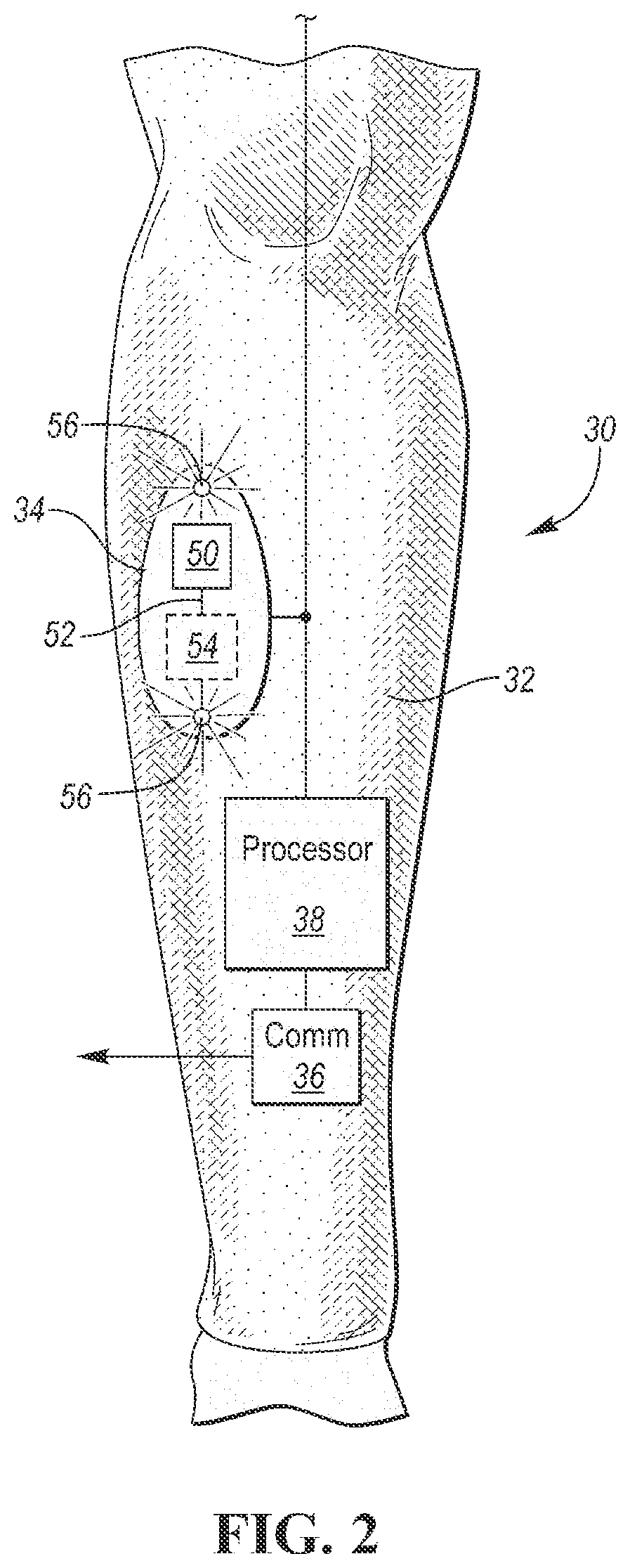Patent US12090320 Figure 2 – Neuromuscular sensing device with multi-sensor array