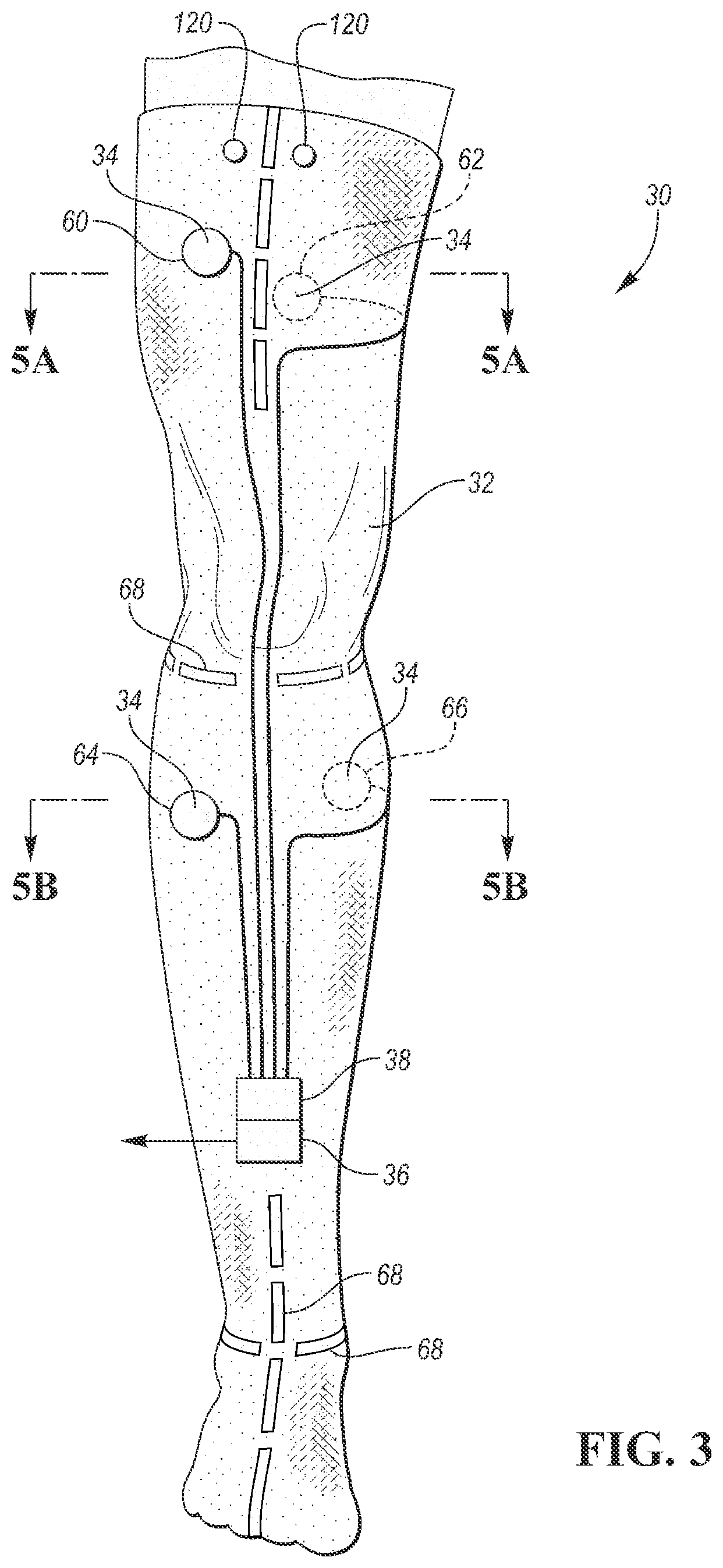 Patent US12090320 Figure 3 – Neuromuscular sensing device with multi-sensor array