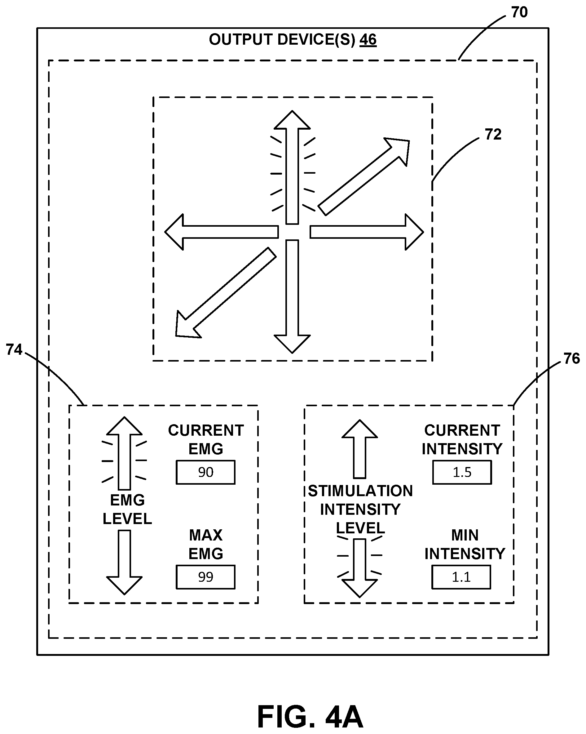 Patent US12090321 Figure 4 – Lead placement for nerve stimulation